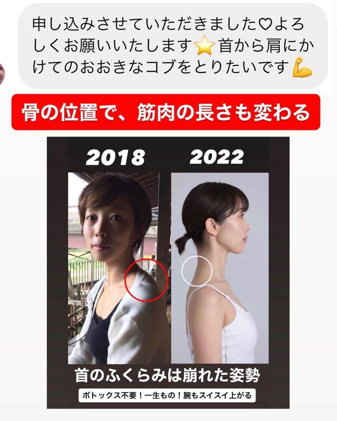 佐川裕香さんのインスタグラム写真 - (佐川裕香Instagram)「【月額オンラインレッスン募集・残り３日】  突然ですが... 『鎖骨』を意識したことはありますか？  大前提、『全身』繋がっているので 『ここだけ』が大事と言うことではありません。  ただよく肩甲骨はがし、肩甲骨ストレッチなど肩甲骨については耳にすることがある方も多いと思います（肩甲骨はがしと言うワードもありますがそもそも肩甲骨は浮いてます）  ですが鎖骨というのはトレーニングを日頃している方でも中々、意識しない部分なのではないでしょうか？  肩甲骨に意識を向けて 肩が上がってしまったり、背中のトレーニングをしてるのに逆に首や肩が凝ってしまう方！  何をしてもガチガチな 首、肩、背中まわりがスッキリ 腕も上がりやすく、スラッとする使い方を  月額オンラインレッスン 9月13日の上半身クラス『鎖骨、リセット。』 で少し視点を変え、その方法をお伝えしています。  ✔︎鎖骨が動く⇄肩甲骨が動く  アーカイブの視聴期限は『レッスン日より2ヶ月間』今回、お申込みでこちらのアーカイブもご視聴間に合います。  いつもとは少し違う視点から、アプローチすることで、 からだの動かし方の変化につながる。  そこから得た小さな気づきがやがて大きな収穫へ  そして着実にボディライン、からだの体感に反映される..  積み重ねは、数ヶ月後に大きな差となります 　　　↓ 　　　↓ 　　　↓  期間限定！月額オンラインレッスンお申込み受付け ▶︎10月7日(土)23:59まで！  プロフィールのURL、MOSHサイトから お申込み受付けさせて頂きます  --------------------------------------------  ✔︎お申込みいただいたその日から 過去２ヶ月分のレッスンアーカイブを視聴可能 ✔︎9割以上の方がアーカイブのみでご参加下さっています  --------------------------------------------  We are accepting applications for monthly online lessons! For more information, please visit the instgram URL✨  https://mosh.jp/services/107752  Languages are here ●Subtitle languages↓ *May be English only in some areas  English/한국어/繁體中文/‎العربية/Italiano Bahasa Indonesia/Svenska/Español/ไทย/Deutsch/Türkçe Français/Tiếng Việ/ Português/Русский  --------------------------------------------」10月4日 18時46分 - yuuka_08