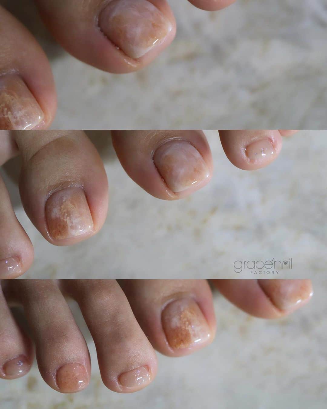gracenailfactoryのインスタグラム：「ゆるーいマーブル  オレンジベージュがかわいい🍊  @gracenailfactory_haruka   ______________________ 《grace'nail factoryのこだわり》  ✔︎design policy ネイルは一番身近な芸術 お客様の満足、感動、好奇心を満たす、オリジナルアートのクリエイションにつとめております  ✔︎育爪policy お爪本来の力を育つよう 丁寧なケア、爪質改善のためのアプローチを行なっています  ・アセトン不使用（当店オフの場合」 ・フィルイン ・ウォーターケア付き ・お爪周りの角質ケア  お爪の健康を大切にしていきたい方 、爪質改善を求めている方、ジェルネイルの持ちを良くしたい方に 喜ばれています  ✔︎おもてなしpolicy お客様が【ここへ来たら元気になれる】と喜んでいただけるような〝心〟ある空間づくりを大切にしています  ✔︎エシカルへの取り組み 人への影響だけではなく、地球環境に配慮した良質な商材選びにこだわっています  ——  @gracenailfactory   大阪市西区南堀江1-21-9 南堀江ビル2階  ☞堀江公園のすぐそば ☞レンガ色の入り口  定休日/木曜日 平日10:00-18:30（最終受付） 土日祝11:00-18:30（最終受付）  #堀江ネイル　#マグネットネイル大阪 #大阪ネイルサロン #ウォーターケアのあるサロン  #育爪ネイルサロン  #フィルイン大阪 #個性派ネイル大阪 #カジュアルネイル大阪 #南堀江ネイルサロン #堀江ネイル #ニュアンスネイル大阪  #フットネイル大阪 #インクアート大阪  #ミラーネイル #大人カジュアルネイル #ネイリスト採用大阪 #巻き爪ケア大阪 #네일 #泡ネイル #バブルネイル #ネイリスト求人大阪 #秋ネイル #nail」