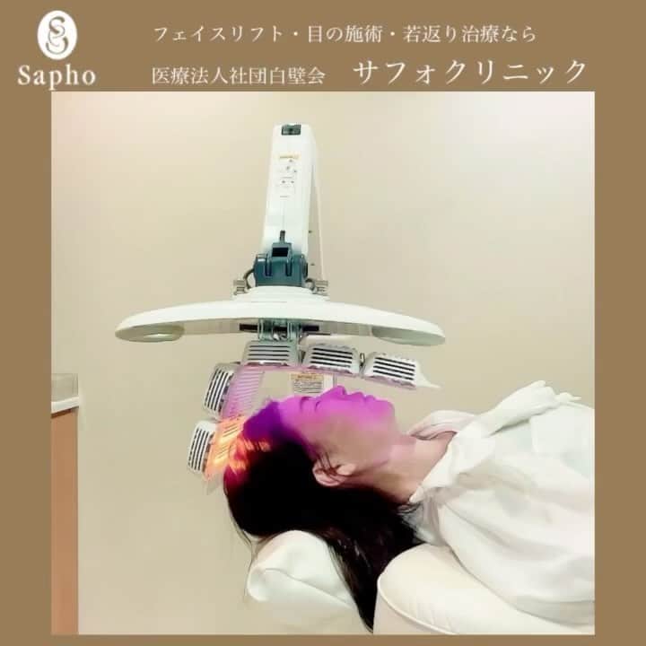 のインスタグラム：「【六本木】サフォクリニックの「PRP育毛治療法」予防だけでなく、着実に“結果”を出す時代へ  女性の薄毛や抜け毛に対する診療ガイドラインの推奨治療法は効果が弱く、男性と比べて確立された方法がないのが実情です。サフォクリニックの「PRP育毛治療法」は、かつての若々しい頭皮環境を取り戻し、自然な再生力で効果が長持ちします。 pRP育毛治療の効果を後押しする、医療用LEDヒーライトは、2つの異なる波長が創傷治癒および頭皮にも最適な環境を作り出します。  サフォクリニックの「PRP育毛治療法」の治療後一ヶ月経過した効果では、成長期が伸びるため毛が太くコシがでて抜けにくく毛の違いを感じるそうです。」