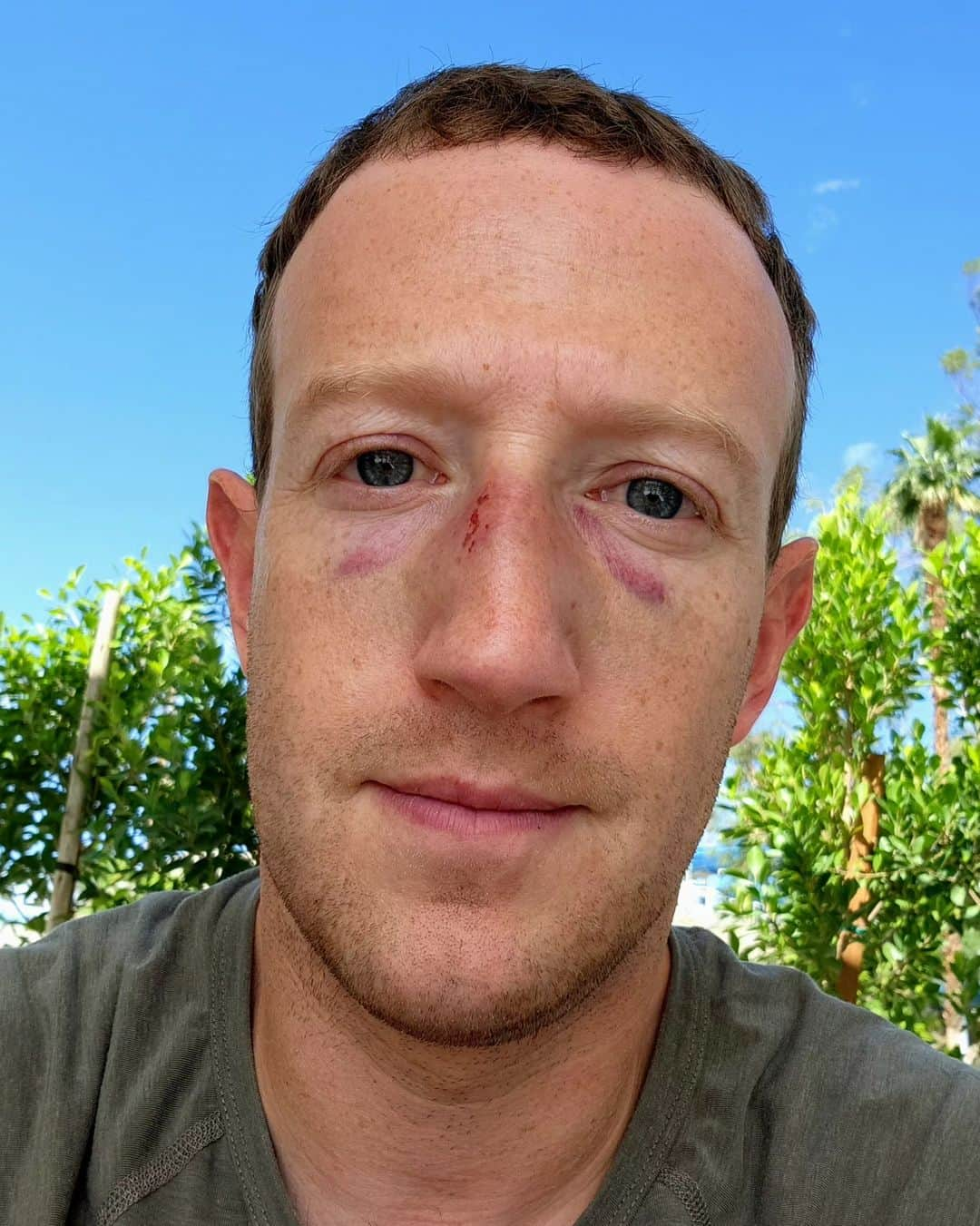 マーク・ザッカーバーグのインスタグラム：「Sparring got a little out of hand. May need to update my avatar 🤣」