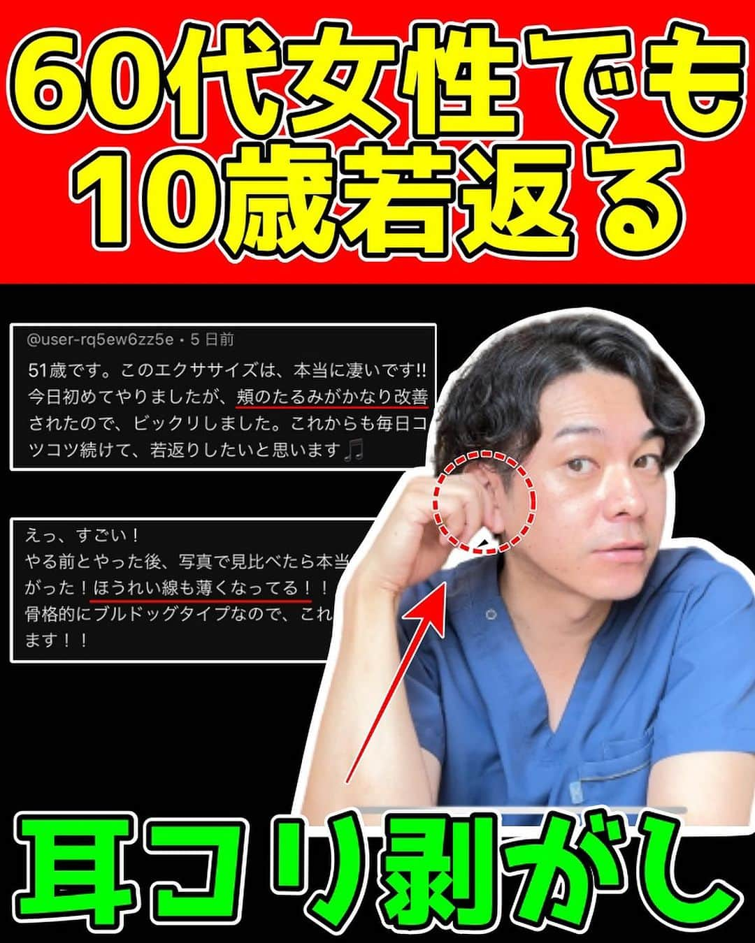 かず先生のインスタグラム：「『セルフ整体師を一家に1人…』をモットーに誰でも簡単に出来る若返りセルフケアを学ぶことが出来ます！！  ほうれい線・顔のたるみ・目のたるみなどの美容系のお悩みの解消はもちろん、姿勢矯正して、痛みを解消する事も 『若返り』と思うので美容以外のお悩みがある方でも参考になると思います✨  まだまだ諦めないでください！！  僕と一緒にコツコツとセルフケアを頑張りましょう！！  自分でセルフケアをマスターして整体と病院を卒業しましょう🔥  ーーーーーーーーーーーーーーーーーーーーー 【かず先生のプロフィール】  ■国家資格の柔道整復師の資格を取得後、大阪の整骨院で分院長として８年間勤務する。  自分の思い通りに施術が出来ない保険治療に嫌気が差し、  2017年に地元である和歌山県で自費治療の整体院紡ぎを開業する。  毎月150人以上の患者様に来院して頂き、日々痛みや美容で悩んでいる方のサポートを行っている。  【実績紹介】  ■YouTube登録者数　38万人(2023年　8月現在)  ■Instagramフォロワー数　28万人(2023年　8月現在)  ■TikTokフォロワー数　27万人(2023年　8月現在)  ーーーーーーーーーーーーーーーーーーーーー  ✨毎日たった1分やるだけで『10歳若返る』簡単セルフケアを配信中✨  実践したら🙌🙌で教えて下さいね🥰  共感、応援してくださる方はフォローお願いします🥰  後から繰り返し見たい人は👆【保存マーク】  今回の内容が参考になったら👍【いいね】  個人的に何が質問があればDMお願いします✨  ーーーーーーーーーーーーーーーーーーーーー  ✨整体院紡ぎ-TSUMUGI-✨ 【和歌山県橋本市/橋本ICから車で7分】  ●体の不調でお悩みの方はプロフィール リンクからお問い合わせください(^^)  ●お悩みをしっかり伺い痛みの原因を探ります ●根本から解消！！【施術・セルフケア・生活習慣サポート】 ●腰痛・五十肩・股関節痛・膝痛など  ——————————————————————— #顔のたるみ #頬のたるみ #フェイスアップ #フェイスライン」