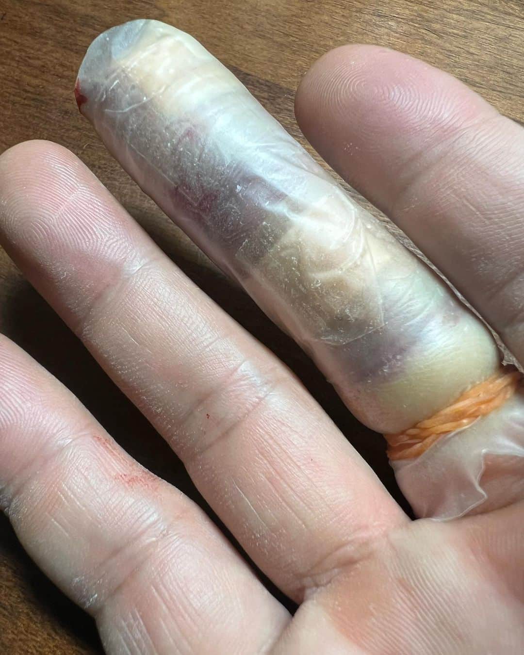 深沢邦之さんのインスタグラム写真 - (深沢邦之Instagram)「やっちまった😭 スライサーで 指先をスライス😱 ざっくりスライスして 血が止まらない😱 こんなに血が出たら 俺、貧血になる？！ なんて恐怖を 感じたくらい血が ドボドボ😱 それでも夕飯を終え 三味線を習いに行った そしたら 先生が 血が三味線についています！って😁 お稽古中止🤣 もうなにも出来ない😭 諦めて 手を上に上げて寝る💤 健康が一番です✌️ 健康でないと あらゆることが 出来なくなり 不便になりますね😅 頑張れ！ 俺の体！俺の指❗️ 3枚目 福島県 安達太良山登山動画の 最終回になります #深沢邦之チャンネル で検索してください シリーズをずっと 見続けて頂き ありがとうございました😊 #深沢邦之 #深沢邦之チャンネル #登山 #日本百名山 #安達太良山 #福島県 #活火山 #剣道 #剣道五段 #リバ剣 #出稽古  　　ふかふかチャオ」10月3日 7時56分 - fukasawakuniyuki