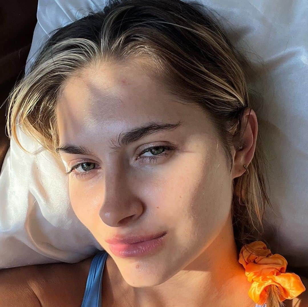 Monica Aksamitのインスタグラム：「september (ft my pimple)」