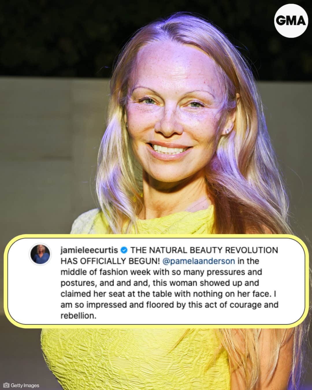 Good Morning Americaさんのインスタグラム写真 - (Good Morning AmericaInstagram)「Women supporting women. ❤️   Jamie Lee Curtis showed admiration for fellow actress and activist Pamela Anderson in a spirited Instagram post over the weekend.  Curtis' commentary came alongside two recent photos of Anderson looking stunning in a yellow dress while attending the Isabel Marant show at Paris Fashion Week. Anderson wore her hair long and loose but slicked back from her face to showcase her fresh-faced look.  Find more at our link in bio.」10月4日 4時25分 - goodmorningamerica