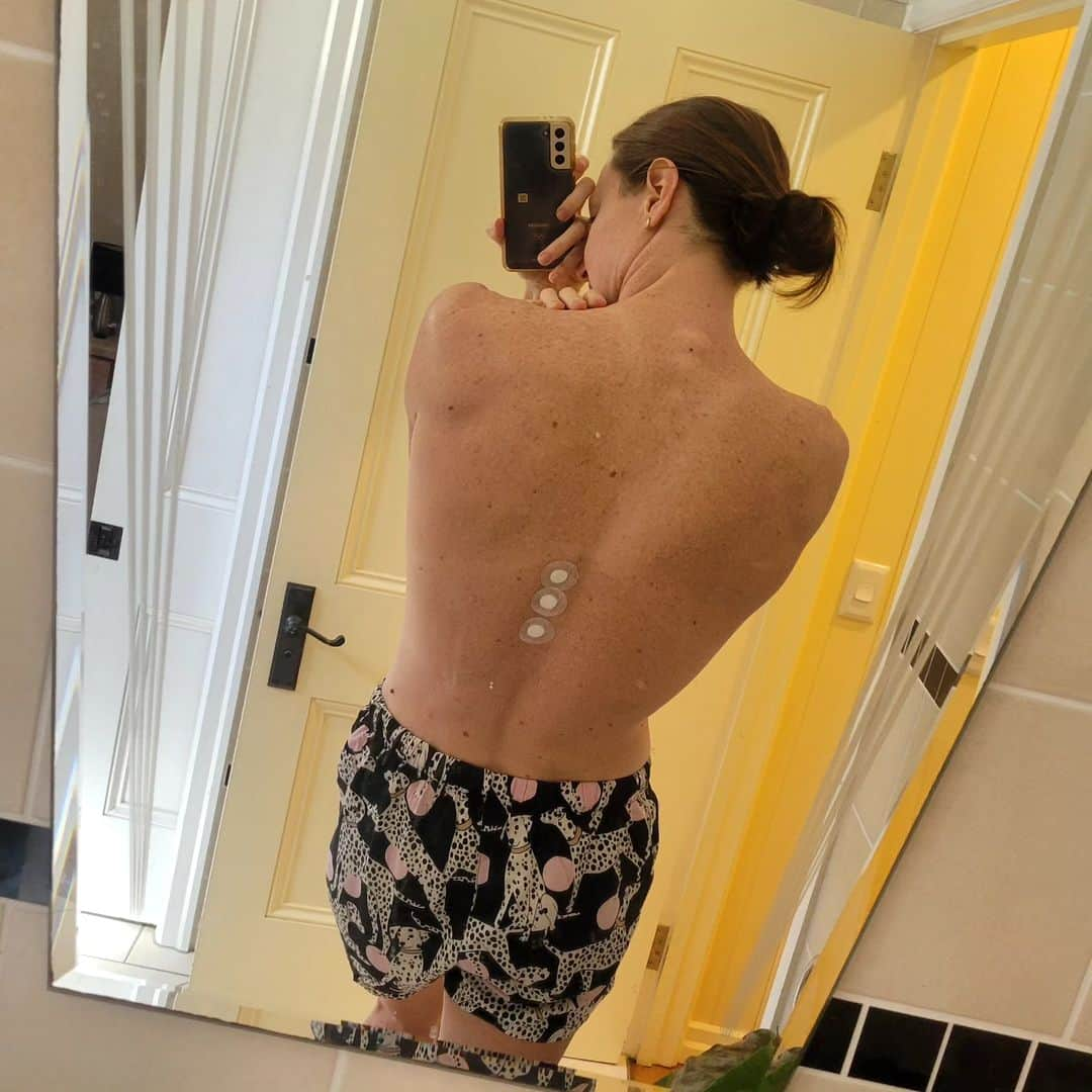 ケイト・キャンベルさんのインスタグラム写真 - (ケイト・キャンベルInstagram)「A moment to appreciate my incredible team! On Friday I had my 3rd cortisone injection in 6 months into some troublesome joints in my back. This time we also tried pulse radio-frequency stimulation to help reset the pain signals to the joints. I want to say a massive thank you to my incredible medical team, physios, doctors and radiographers, you are keeping this old body moving.  They say it takes a village to raise a child, well it takes an army to raise an athlete. Massive shout out and thanks to the Queensland Academy of Sport for making procedures like this available quickly to athletes 🙏 I'm back in the water and feeling good - one perk of having injections is getting the weekend off 😝  #teamwork  @qldacademysport」9月11日 19時05分 - cate_campbell