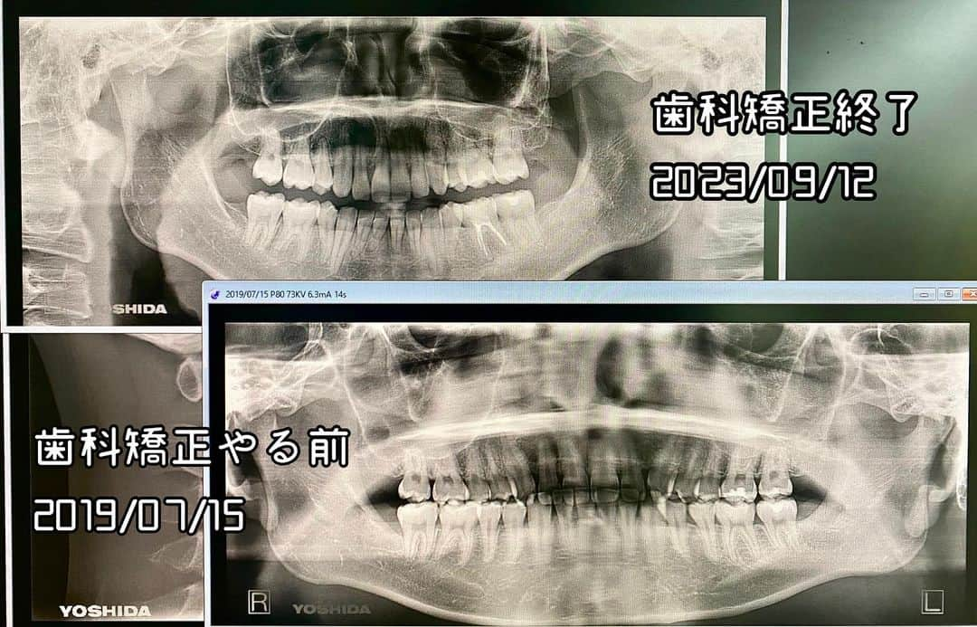 江崎びす子のインスタグラム