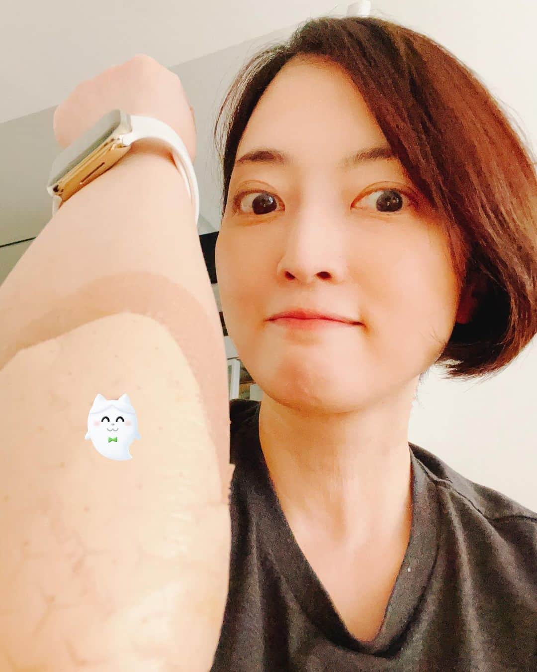 八木沼純子のインスタグラム：「1年前に骨折した肘に入ってたピンとワイヤーを抜き取りました！ 手術後に一瞬だけ、入ってたピンを見せていただいたのですが、結構なものでございました😅✂️✨ 1年間肘を支えてくれてありがとうー。 無事に骨もくっついて、これからも 肘をげんきにフリフリしながら頑張ります。 もう少し静養して、いつもの生活に戻ります。 今回もお世話になりました病院の皆様、 ご迷惑をおかけしました皆様、 申し訳ありませんでした。 有難うございました。  まずは、ご報告まで😌」