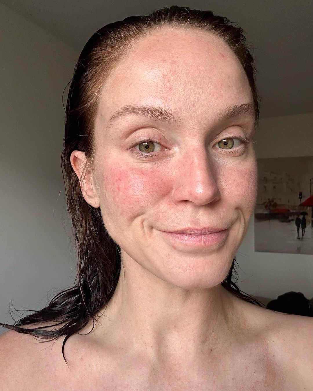 のインスタグラム：「Having PMDD is like building a sandcastle of good habits, positive energy & a loving life only to watch it all get swept away to leave depression, anger & hopelessness in its wake. The wave recedes. You begin to rebuild. Just as a new wave crashes 🥹  I've felt great recently- which I'm genuinely grateful for. The last 7 to 10 days have been amazing. I felt like me. Positive, proactive, enthusiastic about my work, sociable, motivated & full of energy. But the last couple of days, the tide has started to turn & I know what's coming.   I can feel familiar feelings starting to creep back in- a missed call from a number I don't recognise sends my anxiety soaring, I'm exhausted & want to sleep desperately but my mind races & insomnia threatens, I’m constantly on the verge of tears & even the slightest inconvenience has me catastrophizing everything. Dark intrusive thoughts get louder, their narrative becoming increasingly more believable..   You are useless, you aren't successful, you're irrelevant, you're old, you're ugly, no one likes you.. Just give up. 🥹🤦🏻‍♀️  My diagnosis gave me such a sense of validation & a better understanding of why I was feeling the way I was- it was so liberating to know that I wasn't just weak or crazy- there was a reason for why I was feeling the way I was & I wasn't alone either. But it also came with the realisation that I'm going to feel this way every month. Over the last few years I've convinced myself the way I felt was because of my cyst, or my egg freezing, or because I'd had my contraception removed.. But now I know it's not- it's because I have PMDD & that is forever & ever amen 🤦🏻‍♀️😂  And even though I have started my journey to help me find ways to help & alleviate some of the more intense PMDD symptoms- this is going to be my life for awhile. And I've found that abit of a difficult pill to swallow. I think that feeling is exacerbated by the point I am in my cycle aswell to be fair 🤦🏻‍♀️😂  Anyway, the point of this post was this, PMDD is a punch in the dick & if you're suffering with any of the symptoms I've described go & see your doctor & if you've already been diagnosed you're a warrior & you're not alone 🥹💪🏼」