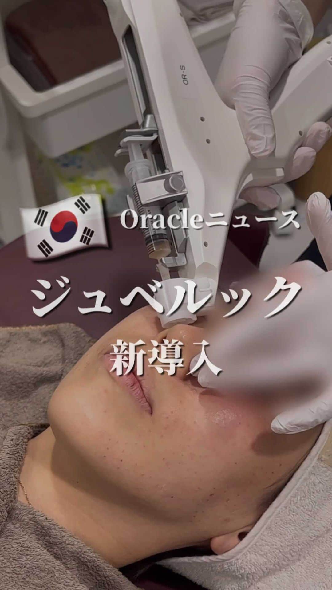 オラクル美容皮膚科東京新宿院のインスタグラム：「【ジュベルック】が新規導入👏 ※新宿院と梅田院　先行導入 ⁡ ⁡ 美容渡韓勢の皆様からのご要望で ついに導入🇰🇷✨ ⁡ デモに時間がかかり大変お待たせいたしました🙇‍♀️ ⁡ ーーーーーーーーー ⁡ 👉ジュベルック 効果は［毛穴］「ニキビ跡」がメイン ⁡ ⁡ ポリ乳酸と非架橋のヒアルロン酸を結合させた 自己組織再生コラーゲンブースター✨ ⁡ 自己コラーゲン産生を促進することで より自然なボリュームUPが期待でき、 肌の弾力、小じわ、毛穴、ニキビ跡の改善にも 効果があります💡 ⁡ ⁡ ⁡ 次回、「ジュベルック」と「リジュラン」の違いについて両方受けたスタッフの感想レポをご紹介予定📝 ⁡ お楽しみに😉 ⁡ ーーーーーーーーー ⁡ ［料金］ ジュベルックの新導入記念👏 ⁡ ①初回限定　全顔（3cc）44,000円 ※通常52,800円 ⁡ ②初回限定　3回セット　132,000円 ※通常158,400円 ⁡ ※麻酔代別途2,200円 ⁡ ⁡ ⁡ ⁡ #ジュベルック #水光注射 #毛穴 #ニキビ跡 #弾力 #韓国美容 #ハリ #艶肌  #水光肌 #美容皮膚科 #渡韓美容 #韓国好きな人と繋がりたい」