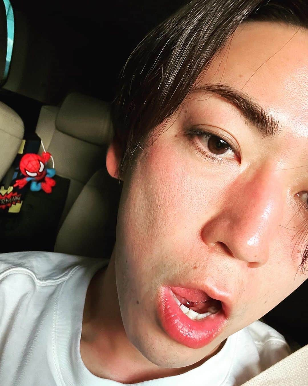 亀梨和也さんのインスタグラム写真 - (亀梨和也Instagram)「日焼けしちゃった、、、☀️  #伝えるのに必死。笑 #自撮り #おでこ #鼻 #ほっぺね #山の上で撮影 #やはり太陽は近かった」9月14日 18時32分 - k_kamenashi_23