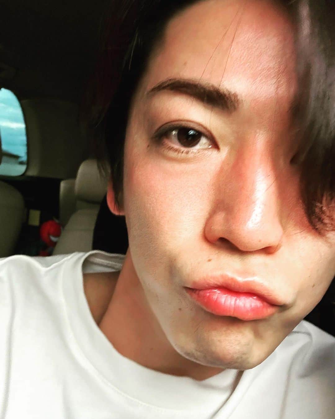 のインスタグラム：「日焼けしちゃった、、、☀️  #伝えるのに必死。笑 #自撮り #おでこ #鼻 #ほっぺね #山の上で撮影 #やはり太陽は近かった」