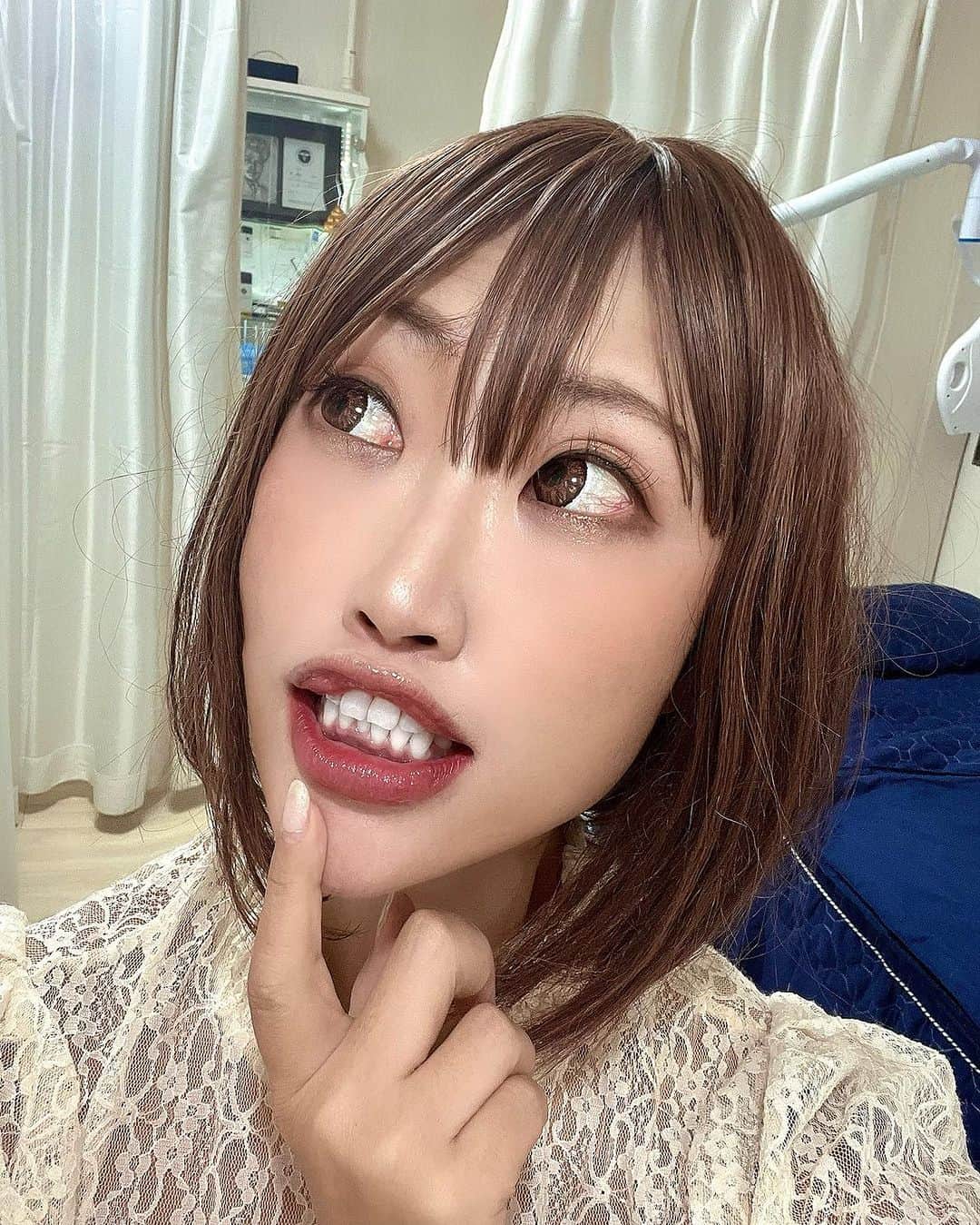 DJ YURINAのインスタグラム：「めっさ白くなった😍 @light_beauty_ebisu さんに ホワイトニングに行って来ました❣️  コーヒーもワインも好きな私からすると本当にホワイトニングはマスト👍 やっぱり歯は白い方が清潔感もあっていいなぁと思います🦷 初対面で歯でがっかりされたくないじゃんさ😘  担当して頂いたのは @kimono_no_jun さん ありがとうございました❣️  白さ比較は2枚目動画から♫ 20分程度でできる施術なので気になる方は是非行ってみてね❣️  #ホワイトニング #ホワイトニングサロン #セルフホワイトニング #恵比寿 #ライトビューティー恵比寿」