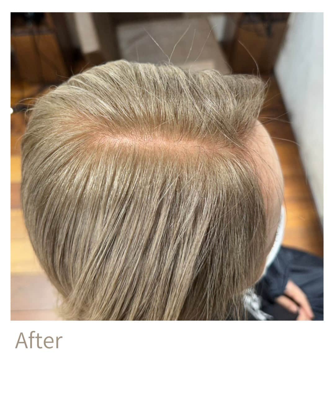 Wella Professionals Japanさんのインスタグラム写真 - (Wella Professionals JapanInstagram)「コレストンの新色「リュクスベージュ」で、は、白髪多めの方の白髪活かしにおすすめ。根元のリタッチでつなぎながら、白髪を育てていくことができます。 ・ <Before> 新生部／18Lv 既染部／18Lv 白髪率／70%以上  <Color> 根元／リュクスベージュ〔ox3%〕  明るいブロンドベージュになるリュクスベージュで白髪を活かしました。白髪活かしは白髪・黒髪のコントラストを残しながら根元と毛先の色をつないでいくのがポイントです。リュクスベージュは、3%で白髪も染まり黒髪も明るくならないので褪色経過もいいですし、頭皮への負担も配慮したカラーをすることが出来ます。  by 西川 万由さん(nex the salon) 　@manyuu0405  ●リュクスベージュ● まろやかで落ち着きを感じるナチュラルベージュ。 年齢肌にも自然になじみ、肌色をくすませず優しい印象に。 白髪率が高い方へのオンカラーに。  ・  リュクスカラーコレクションの情報は、コレストンワークスをチェック！ https://koleston.wella.co.jp/works/tags/luxecolorcollection/  ・ #コレストン #新色 #リュクスカラーコレクション #リュクスベージュ #脱白髪染め #白髪活かし #大人髪  #ウエラ  #ウエラカラー #ヘアカラー  #サロンカラー #美容室 #美容師  #コレストンワークス  #脱白髪染めラボ」9月15日 18時00分 - wellapro_japan
