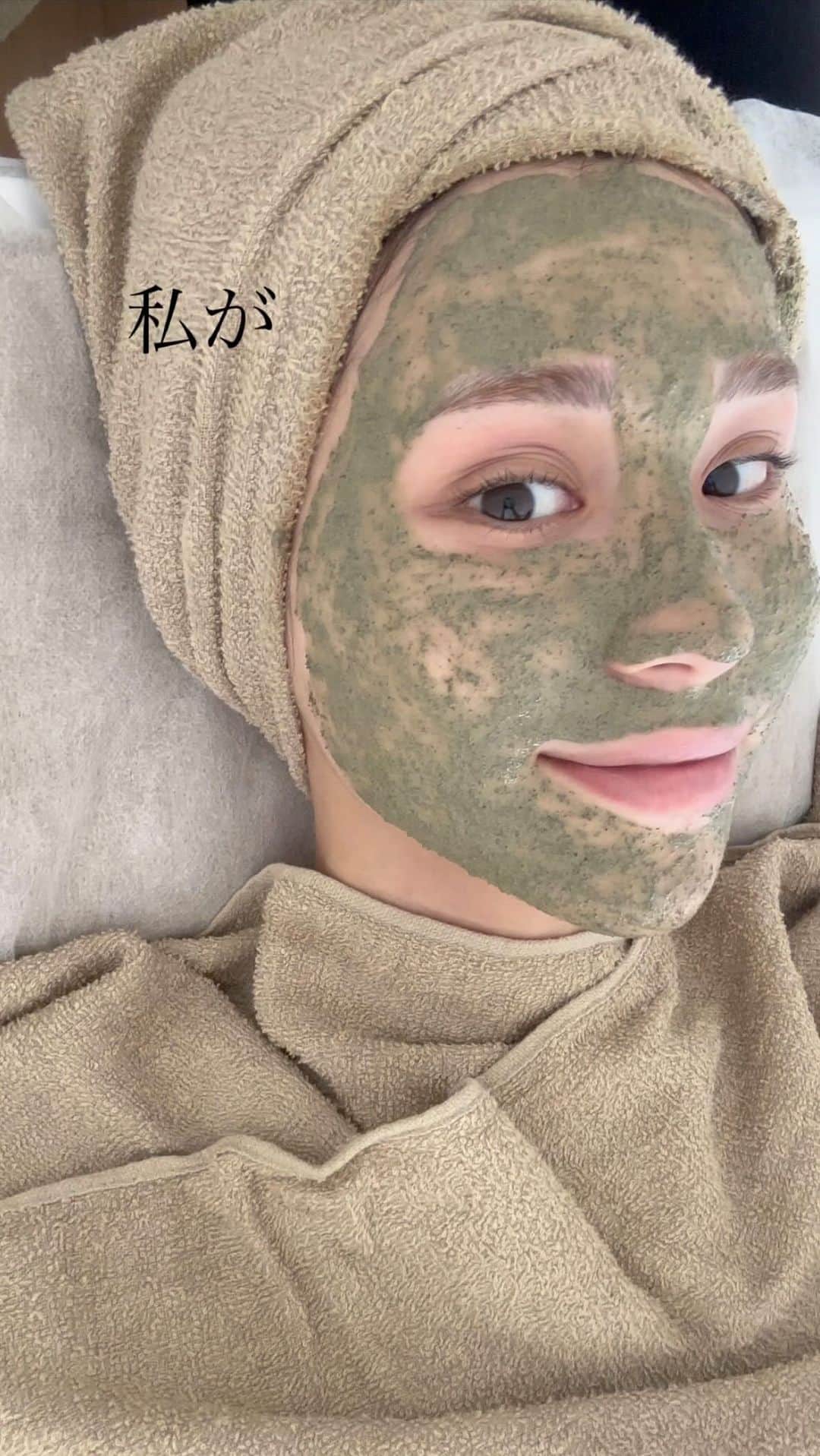 のインスタグラム：「. 私がルヴィを選び開業した理由は、 10年間荒れていた肌が 改善したからです🥚✨  エステティシャンとして お客様を綺麗にする立場なのにも関わらず、 めちゃくちゃ肌荒れをしていました🥲  スキンケアも食事も頑張っていたつもりだけど、 どうしても改善せず。  誰に聞いても最終的に言われるのは、 『食事が原因だね』でした。  綺麗になっても、1ヶ月後のご来店には またニキビができているお客様も沢山で。 お話しを聞けば、 『夜勤があって寝不足で、、、』 『ピルをやめたらニキビが、、、』 『いつもよりも食べ過ぎちゃってお肌が、、、』  じゃあ何も食べるなってこと？ そもそもエステで肌質改善はできないの？ エステの必要性は？  と自分もお客様も肌荒れ改善しない事に どうしたら良いんだろうと 途方に暮れていました。  そんな時たまたまSNSで見つけたのが ハーブピーリング　REVI ルヴィ  すごく顔をゴシゴシしていて摩擦凄そうだなー お肌弱い私には向いてないだろうなー、 と疑いつつも半年間お客様として施術を受け、 ホームケアも全て細胞ケアに変えました。  すると人生で初めて ニキビとニキビ跡がなくなりました✨  私には『細胞美容』が必要だったのかと REVIの凄さに衝撃を受けました⚡️  お客様のお肌悩みがなかなか改善しなくて 悩んでいるエステティシャンの方  未経験だけどエステサロンを開業したい方  ネイル、マツエク、脱毛、美容院の新メニューで フェイシャルをやりたい方  導入のご相談承っておりますので、 お気軽にご連絡お待ちしております💌」