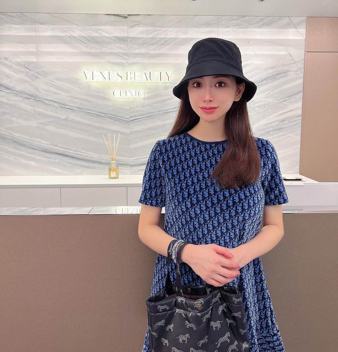 南杏奈のインスタグラム：「@venus_beauty_clinic 新宿院で フォトフェイシャルM22の施術をしてきました💆‍♀️✨  定期的に受けてる肌管理のひとつ💕  M22は肌が白く綺麗になるし とてもおすすめ✨  いつもありがとうございます🤍  #フォトフェイシャル #m22 #venusbeauty #venusbeautyclinic #肌管理 #美容 #光治療」