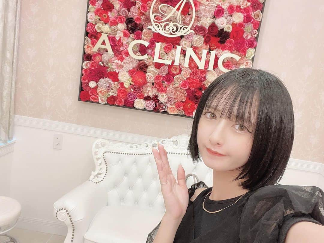 峯宇美七虹（みな氏）さんのインスタグラム写真 - (峯宇美七虹（みな氏）Instagram)「⌇ ⁡ ⁡ @aclinic_shinjuku で目の下の膨らみ取りの施術を片桐先生 @aclinic_katagiri にして頂きました！ ⁡ 目の下のふくらみがコンシーラーでも隠れずに 老けて見えるのが悩みだったので受けました ⁡ まだ腫れが治っていないので 安定する1ヶ月後が楽しみです。 ⁡ しっかりとカウンセリングしてもらえて 私の場合脂肪を取りすぎないほうが良いと診断してくれたり 安心して受けられました。 ⁡ 次するとしたら二重の形が左右差あるので 綺麗に整えたいです◎ 	 ⁡ ˗˗˗˗˗ ⁡ #目の下のふくらみとり#目の下のクマ#目の下の脂肪#クマ取り#クマ治療 #aclinic #aクリニック #エークリニック#aclinic銀座 #aclinic横浜#aclinic新宿#aclinic名古屋#aclinic大阪#aclinic池袋 #aclinic福岡 #aclinic仙台 #美容外科 #美容皮膚科 #片桐大佑」9月16日 21時20分 - _mina37stagram_