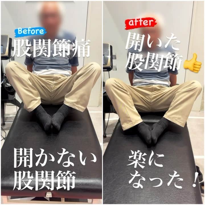 兼子ただしのインスタグラム：「股関節痛〜高齢者の悩み、 神経系ストレッチで解決👍  やはりストレッチは医学にするしかない❗️」