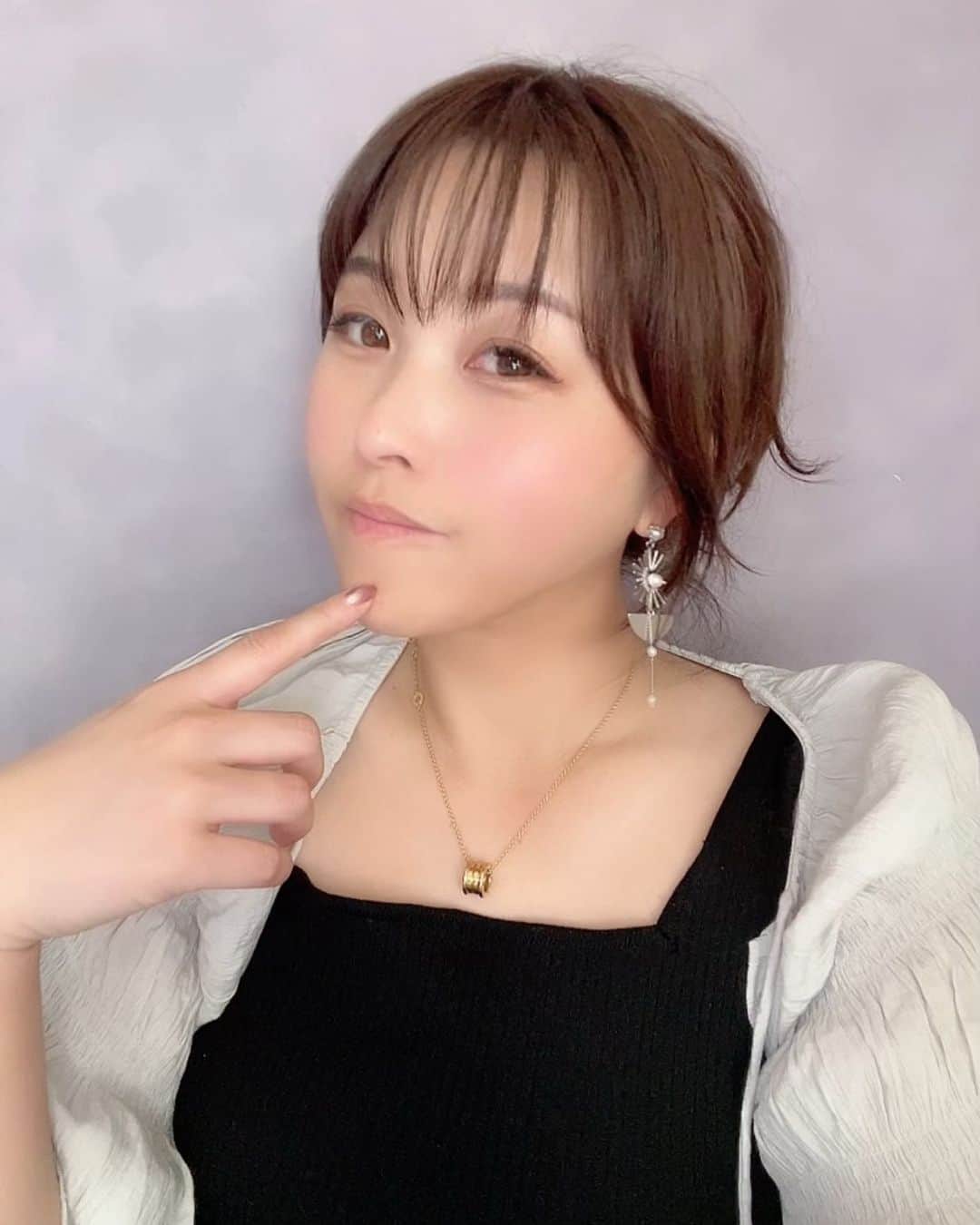 mikaのインスタグラム：「♥︎︎∗︎*  東京中央美容外科越谷院の中村先生に TCB式小顔美肌再生をしてもらったよ👨‍⚕️🩺  @tcb_nakamura_hiroshi  @tcb_koshigaya   マリオネットラインが気になると伝えたら 中村先生の見事な調整加減で理想の仕上がり🥰  しかも当日腫れるの覚悟してたのに全然だし、 今はまだ麻酔残ってて上手く笑えないけど これからが楽しみで仕方ない💕  美肌効果もあるからそっちも今後楽しみ✨  #pr  #東京中央美容外科 #埼玉 #糸リフト #小顔整形 #TCB式小顔美肌再生」