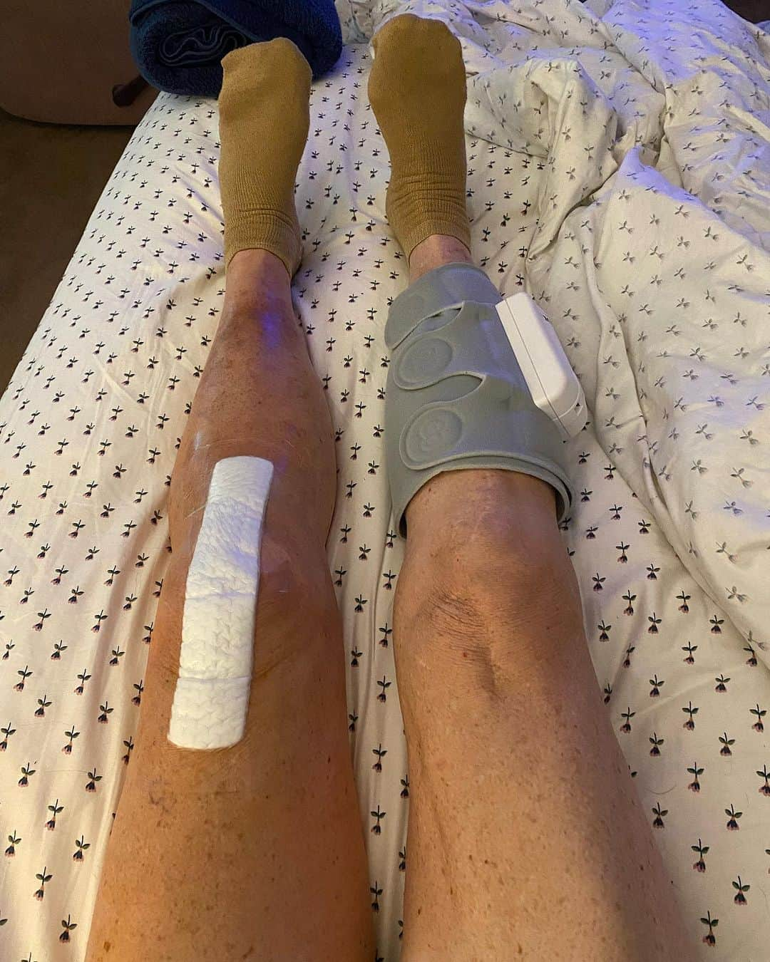 ドット=マリー・ジョーンズさんのインスタグラム写真 - (ドット=マリー・ジョーンズInstagram)「I haven’t post anything about my knee replacement. I know my girl @bridgettcjones had but wanted to as well. My knee was a mess and this was the 8th surgery on my left one. I think I got my miles out of it. 9-12-23 was surgery! Have had some very bad days but slowly getting better! Thank you @bridgettcjones for being an amazing nurse and taking good care of me . I love you forever and always.  I made that fancy cup and stuff holder for my Walker!!! Jealous 😉love y’all! I’ll keep y’all up to date! Today is day 8. Ya don’t count the day ya had the surgery cause ya don’t!!!」9月21日 9時59分 - dotmariejones