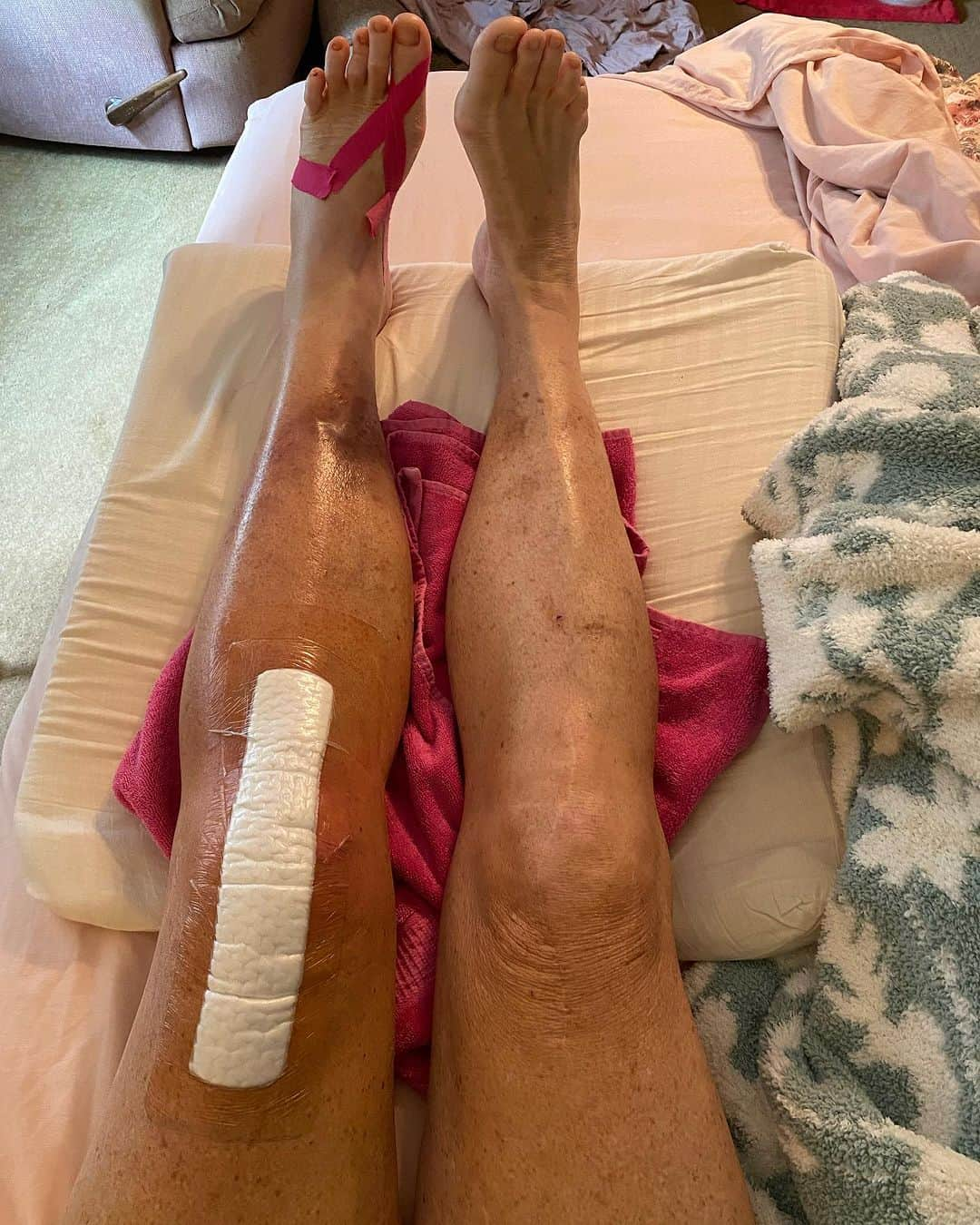 ドット=マリー・ジョーンズさんのインスタグラム写真 - (ドット=マリー・ジョーンズInstagram)「I haven’t post anything about my knee replacement. I know my girl @bridgettcjones had but wanted to as well. My knee was a mess and this was the 8th surgery on my left one. I think I got my miles out of it. 9-12-23 was surgery! Have had some very bad days but slowly getting better! Thank you @bridgettcjones for being an amazing nurse and taking good care of me . I love you forever and always.  I made that fancy cup and stuff holder for my Walker!!! Jealous 😉love y’all! I’ll keep y’all up to date! Today is day 8. Ya don’t count the day ya had the surgery cause ya don’t!!!」9月21日 9時59分 - dotmariejones