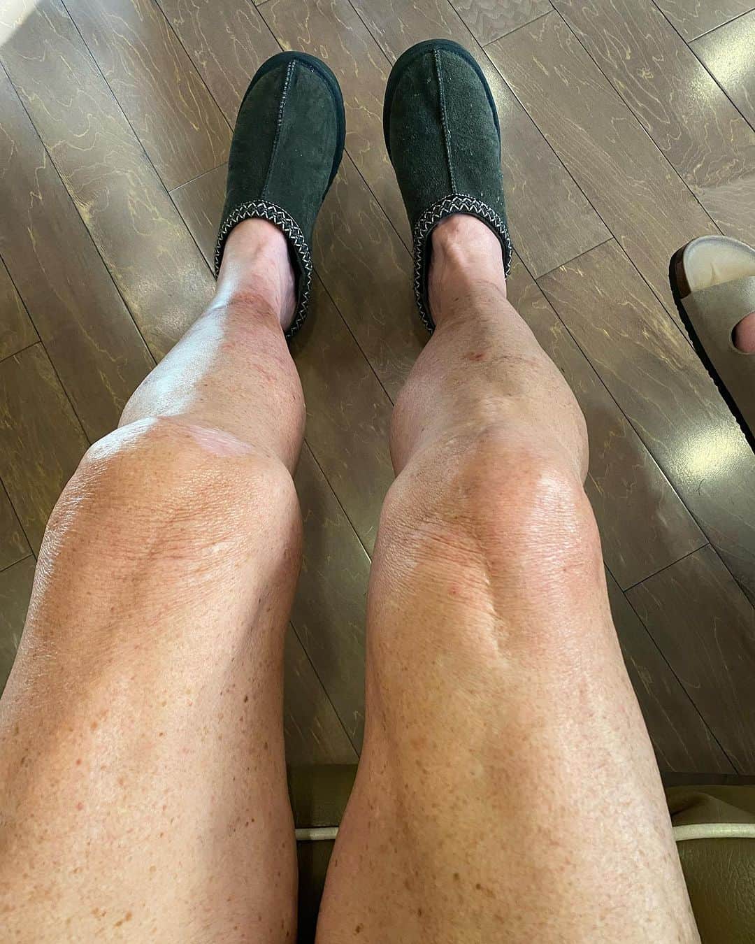 ドット=マリー・ジョーンズのインスタグラム：「I haven’t post anything about my knee replacement. I know my girl @bridgettcjones had but wanted to as well. My knee was a mess and this was the 8th surgery on my left one. I think I got my miles out of it. 9-12-23 was surgery! Have had some very bad days but slowly getting better! Thank you @bridgettcjones for being an amazing nurse and taking good care of me . I love you forever and always.  I made that fancy cup and stuff holder for my Walker!!! Jealous 😉love y’all! I’ll keep y’all up to date! Today is day 8. Ya don’t count the day ya had the surgery cause ya don’t!!!」