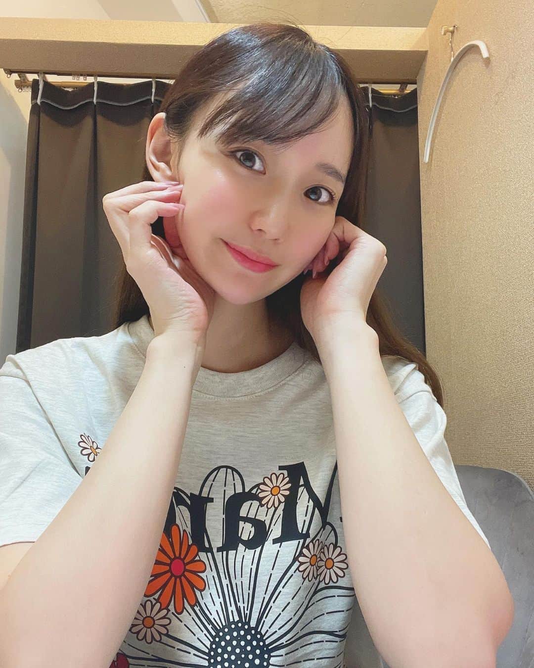 大段舞依のインスタグラム：「⁡ ⁡ ⁡ before→after見たら一瞬で分かるぐらい 顔がスッキリしてる🥺💕 ⁡ 東京中央美容外科中野院で( @tcb_nakano ) 住尾先生( @tcb_sumino_hirotaka )にハイフを していただいて1ヶ月！ ⁡ 顔や首のたるみも少なくなって嬉しい！！ 将来のたるみ予防にもなるから定期的に頑張ろ♡ (もうすぐ、天使の日きちゃうし🤫笑) ⁡ ⁡ #東京中央美容外科 #東京中央美容外科中野院 #tcb #美容整形 #東京 #中野 #ハイフ #HIFU #美容外科 #セレネハイフ #住尾祥隆 #pr  ⁡」