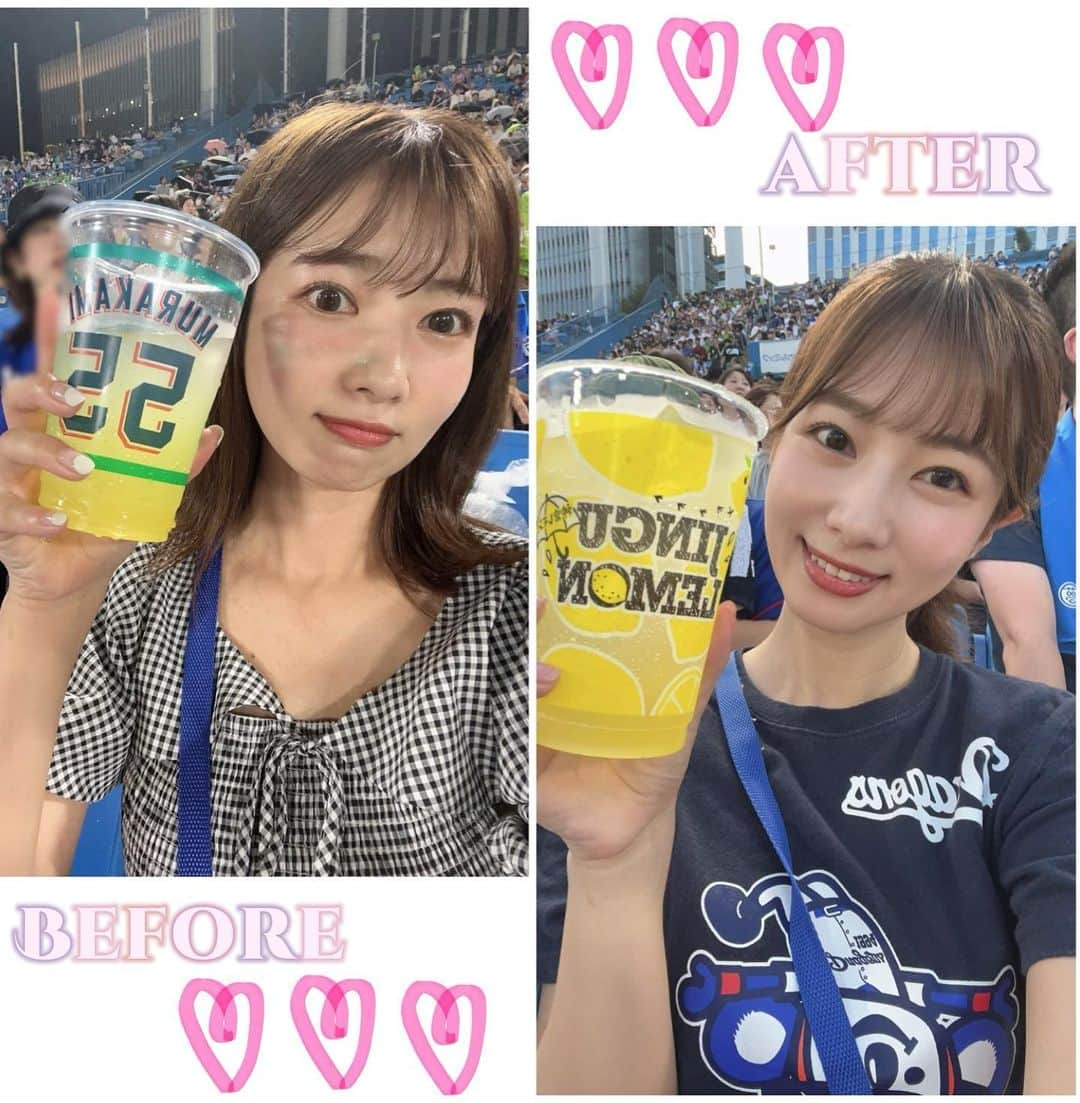 石岡真衣さんのインスタグラム写真 - (石岡真衣Instagram)「⭐︎なぜか投稿消えちゃったので再投稿😕  #TCB式小顔美肌再生　の効果..♡  東京中央美容外科大宮西口院（ @tcb_omiyanishiguchi ）で院長の樅山先生（ @tcb_momiyama ）に #TCB式小顔美肌再生　をしてもらって１ヵ月..  リフトアップして小顔になってる!!!! 写真だと分かりずらいかもだけど肌の再生効果もあって 化粧ノリも良くなってます!!!  （分かりやすいようにどっちも観戦写真で🙃笑）  #東京中央美容外科 #大宮 #糸リフト #小顔整形  #TCB式小顔美肌再生  #pr」9月26日 9時35分 - ishiokamai