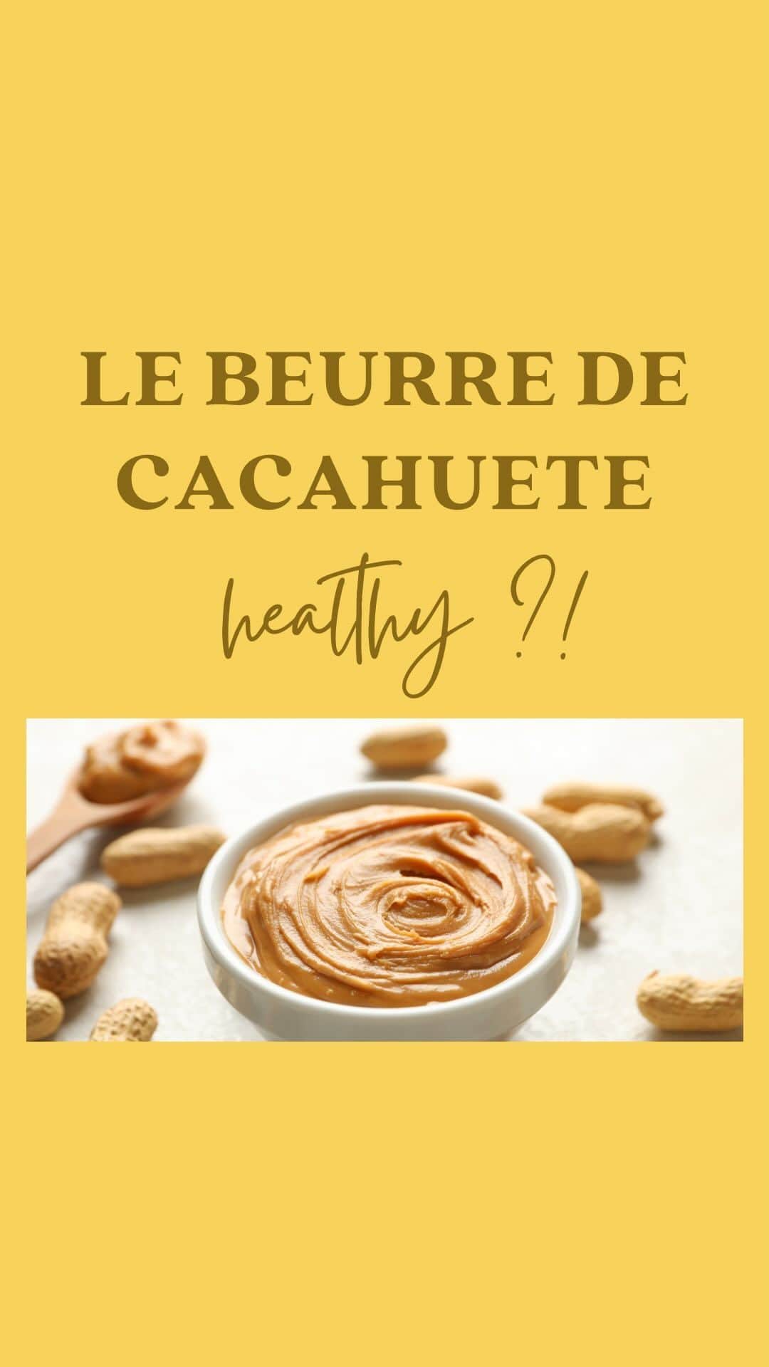 マチルド・ベセーラのインスタグラム：「𝐌𝐲𝐭𝐡𝐞 : le peanut butter bon pour la santé ? ❌ On le voit partout dans la “healthy food” et chez les sportifs (il est certes riche en protéines végétales, en minéraux et vitamines B) mais en fait, il n’est 𝐩𝐚𝐬 𝐝𝐮 𝐭𝐨𝐮𝐭 𝐡𝐞𝐚𝐥𝐭𝐡𝐲 … ! 😱  𝐏𝐎𝐔𝐑𝐐𝐔𝐎𝐈 ?!   ➡️ Car il extrêmement riche en acides gras oméga-6 qui sont 𝐩𝐫𝐨-𝐢𝐧𝐟𝐥𝐚𝐦𝐦𝐚𝐭𝐨𝐢𝐫𝐞𝐬 et mettent 𝐥𝐞 𝐟𝐞𝐮 dans ton corps 🔥  🟰 Ce qui se traduit par plus de douleurs, de blessures, de fatigue, d’infections,… et à long terme de sérieux problèmes de santé 🏥💉  ➡️ Il est très 𝐜𝐚𝐥𝐨𝐫𝐢𝐪𝐮𝐞 ! Donc si tu souhaites surveiller ta ligne, il vaut clairement mieux l’éviter 🍩  Je te conseille donc de le remplacer par de la purée 𝐝’𝐚𝐦𝐚𝐧𝐝𝐞𝐬 complète ou de 𝐧𝐨𝐢𝐬𝐞𝐭𝐭𝐞𝐬 🌰 qui sont beaucoup plus 𝐧𝐮𝐭𝐫𝐢𝐭𝐢𝐯𝐞𝐬 et composées de 𝐯𝐫𝐚𝐢𝐞𝐬 𝐛𝐨𝐧𝐧𝐞𝐬 𝐠𝐫𝐚𝐢𝐬𝐬𝐞𝐬!   #naturopathie #peanutbutter #health #healthyfood #alimentation #santé #santénaturelle #naturo」