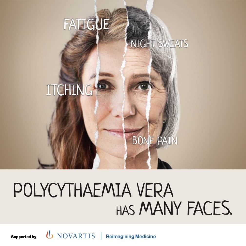 ノバルティスさんのインスタグラム写真 - (ノバルティスInstagram)「This #BloodCancerAwarenessMonth, Novartis stands in solidarity with those living with blood cancers and serious blood disorders and the caregivers supporting them. We recognize the collective strength of the global community coming together to raise awareness and support those affected by blood cancers and serious blood disorders. It's through shared efforts from all corners of the world that we can make a difference. #InnovationIsInOurBlood」9月27日 23時00分 - novartis