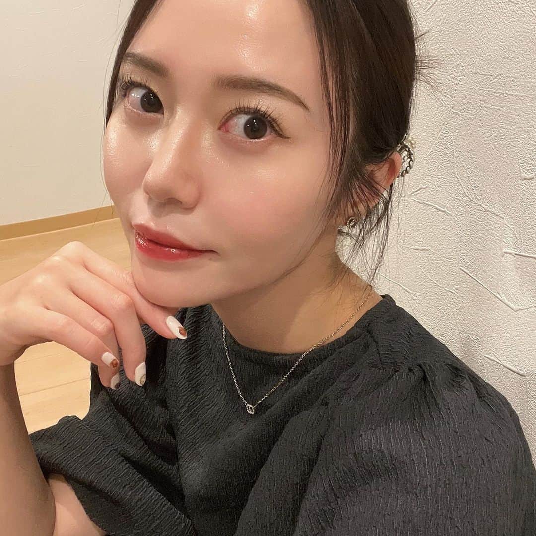 村田莉のインスタグラム：「ちょっと久しぶりになってしまったけど、職場で @selectclinic ハイフしました！！🫰🏻  クリニックでも上位を争うくらい、自分のたるみにうるさい女だと思います。自覚ありです🤫  老けたくないからあらがいますの、全力で🥹  定期的なメンテナンスが本当に大事。。🥺🫰🏻昔の方が絶対たるんでた！今の方がたるんでない！バイバイ二重顎！！  うちは美容経験長い看護師さんばかりだから、いつも安心してまかせている🥹🫶感謝。  あ、久しぶりの自撮りだ。  #美容 #美容医療 #たるみ改善 #フェイスライン #セレクトクリニック」