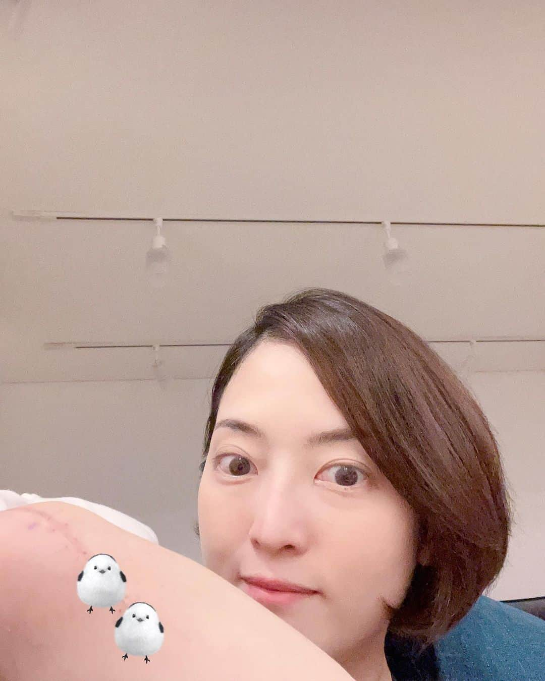 八木沼純子さんのインスタグラム写真 - (八木沼純子Instagram)「抜糸完了ー。 ・ ・ ・ #術後の診察も問題なく #抜糸  #あれから1年😅 #気をつけよう  #先日もズテーンと #やらかしました 🤣 #左靴エッジもう少し様子見」9月29日 3時32分 - junko_yaginuma