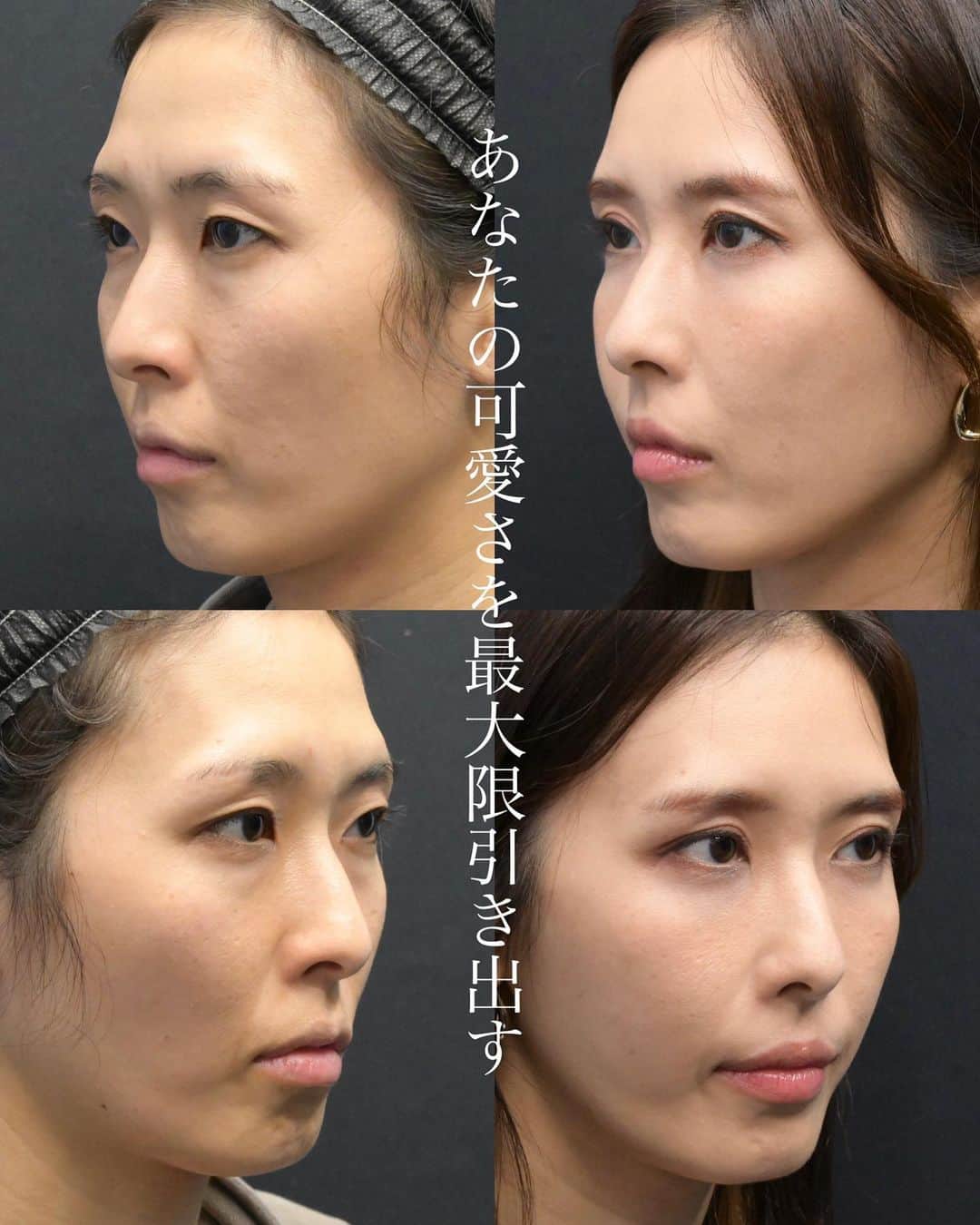 湘南美容外科 柏院のインスタグラム