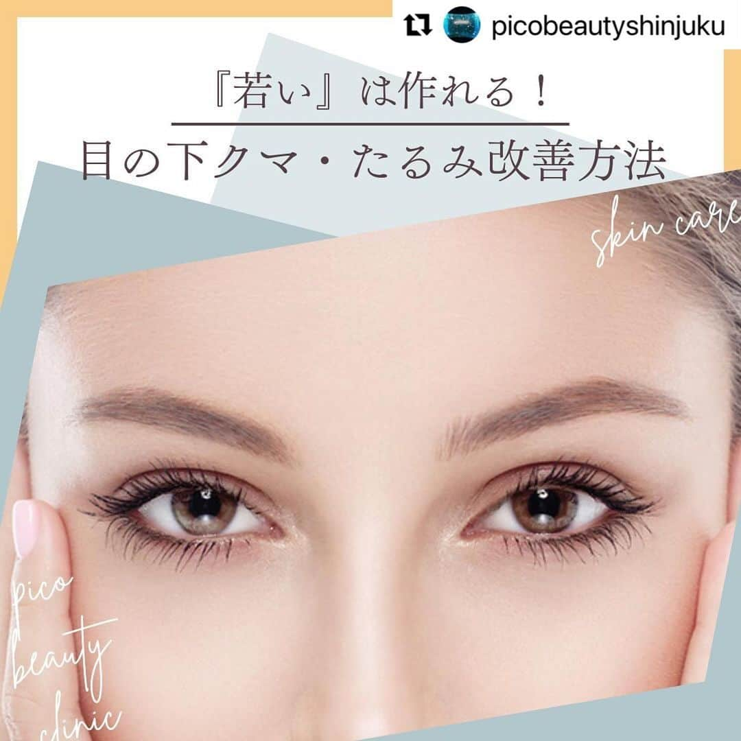 YAG BEAUTY CLINICさんのインスタグラム写真 - (YAG BEAUTY CLINICInstagram)「#Repost @picobeautyshinjuku with @use.repost ・・・ 『若い』は作れます！目の下のクマ&たるみについてご紹介しています💁‍♀️  ✅顔が疲れて見える ✅老けて見える ✅目の下がぽこっとしてる ✅コンシーラーで隠れない ✅目元や表情の暗い印象 ✅一度で自然な若返りをしたい ✅目元すっきりしたい などなど様々なお悩みに💁‍♀️  ご予約・お問い合わせにつきましては当院までお電話お待ち致しております🙇‍♀️ 💎PICO BEAUTY CLINIC💎 〒160-0022 東京都新宿区新宿3-29-17新盛堂ビル8階 📲0120-900-253  #美容クリニック #美容外科 #美容皮膚科 #美容看護師 #picobeautyclinic #ピコビューティークリニック #ピコレーザー #新宿東口 #新宿 #ピコシュア #ピコトーニング #ピコフラクショナル#ピコスポット #シミ取り #シミ取り放題 #ピコシュアならピコビューティークリニック  #肌育  #アンチエイジング　#スキンケア #美白ケア #ダウンタイム #若返り #肌治療 #肌質改善 #たるみ取り #脂肪取り #症例写真 #下眼瞼脱脂 #クマ取り  @yagbeauty_official」10月29日 14時27分 - yagbeauty_official