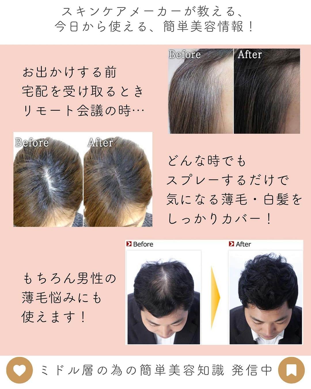 EBiS化粧品【公式】さんのインスタグラム写真 - (EBiS化粧品【公式】Instagram)「@ebis_cosme ≪今日からできる簡単美容✨ 𓂃𓂃𓂃𓂃𓂃𓂃𓂃𓂃𓂃𓂃𓂃𓂃𓂃𓂃𓂃𓂃𓂃𓂃 白髪と薄毛を瞬時にカバー！  気になる部分にスプレーするだけで、 自然にボリュームアップ＆白髪カバー✨ しっとりとした髪質を保ちつつ、 自然な仕上がりで違和感ナシ◯  水や汗にも負けないスプレーだから、安心して使えます 自信の髪型を手に入れましょう💕 𓂃𓂃𓂃𓂃𓂃𓂃𓂃𓂃𓂃𓂃𓂃𓂃𓂃𓂃𓂃𓂃  へ～と思ったら▷『いいね』 あとで見返したいとき▷『保存』 気なること▷『コメント』  @ebis_cosme ≪フォローして見逃さない🌸 𓂃𓂃𓂃𓂃𓂃𓂃𓂃𓂃𓂃𓂃𓂃𓂃𓂃𓂃𓂃𓂃𓂃𓂃  *⸜ エビス化粧品のお取り扱い ⸝* 𓂃𓂃𓂃𓂃𓂃𓂃𓂃𓂃𓂃𓂃𓂃𓂃𓂃𓂃𓂃𓂃𓂃𓂃  ❥エビスオンラインショップ 🔎エビス化粧品で検索  ❥各ECサイト 正規販売店 「モテビューティー」 にて販売中  ❥バラエティショップ・コスメショップ 𓂃𓂃𓂃𓂃𓂃𓂃𓂃𓂃𓂃𓂃𓂃𓂃𓂃𓂃𓂃𓂃𓂃𓂃  #エビス化粧品  #時短美容 #美容オタク #買って良かったもの #ヘッドスパ #美髪 #頭皮ケア #薄毛対策 #ヘアケア #産後ケア #産後ハゲ #育毛剤 #育毛 #ヘアモーメント」10月26日 18時34分 - ebis_cosme