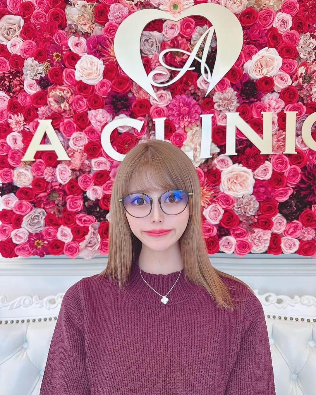 志崎ひなたさんのインスタグラム写真 - (志崎ひなたInstagram)「#aclinicデンタル の瀬里先生　@aclinic_seri にスマイルリップしてもらってきました💕 口角がきゅっと上がったM字リップにしてもらいたかったの🥺 　 理想通りの唇の形になって大満足🥺🤍 先生すごく優しいし、院内も広くてとっても綺麗でした✨ またAスレッドやってもらいたいな👼🏻  2枚目の写真、上がビフォーで下がアフターです💕  #スマイルリップ #aclinic #aクリニック #エークリニック #aclinicデンタル #aclinicdental #デンタルクリニック  #審美歯科 #矯正歯科 #リップヒアル #唇ヒアルロン酸 #口角ボトックス #M字リップ #Cカールリップ  #アヒル口 #リップ #リップグロス #ラシャスリップス #渡邉瀬里」10月26日 19時14分 - shizaki_hinata