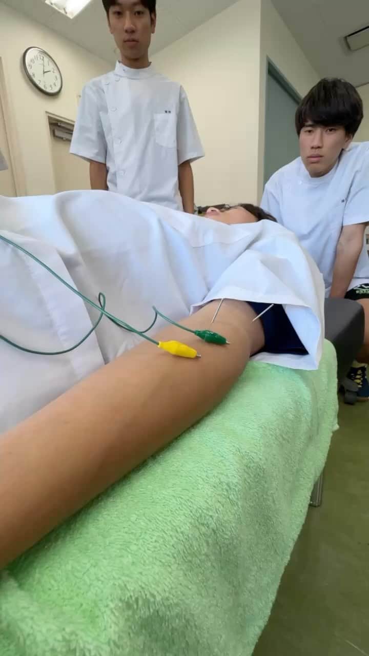 のインスタグラム：「鍼灸スポーツ学科の1年生がはじめての鍼通電を行いました🙌 腕橈骨筋にパルスにて鍼通電！周波数を変えながらピクピクしている筋肉を観察しました👀✨  #大阪ハイテク #専門学校 #医療 #スポーツ #バイオ #再生医療 #人工知能 #授業 #実習 #アスレティックトレーナー #鍼灸師 #柔道整復師 #臨床工学技士 #バイオ技術者 #AIエンジニア #新大阪 #高校生 #部活」