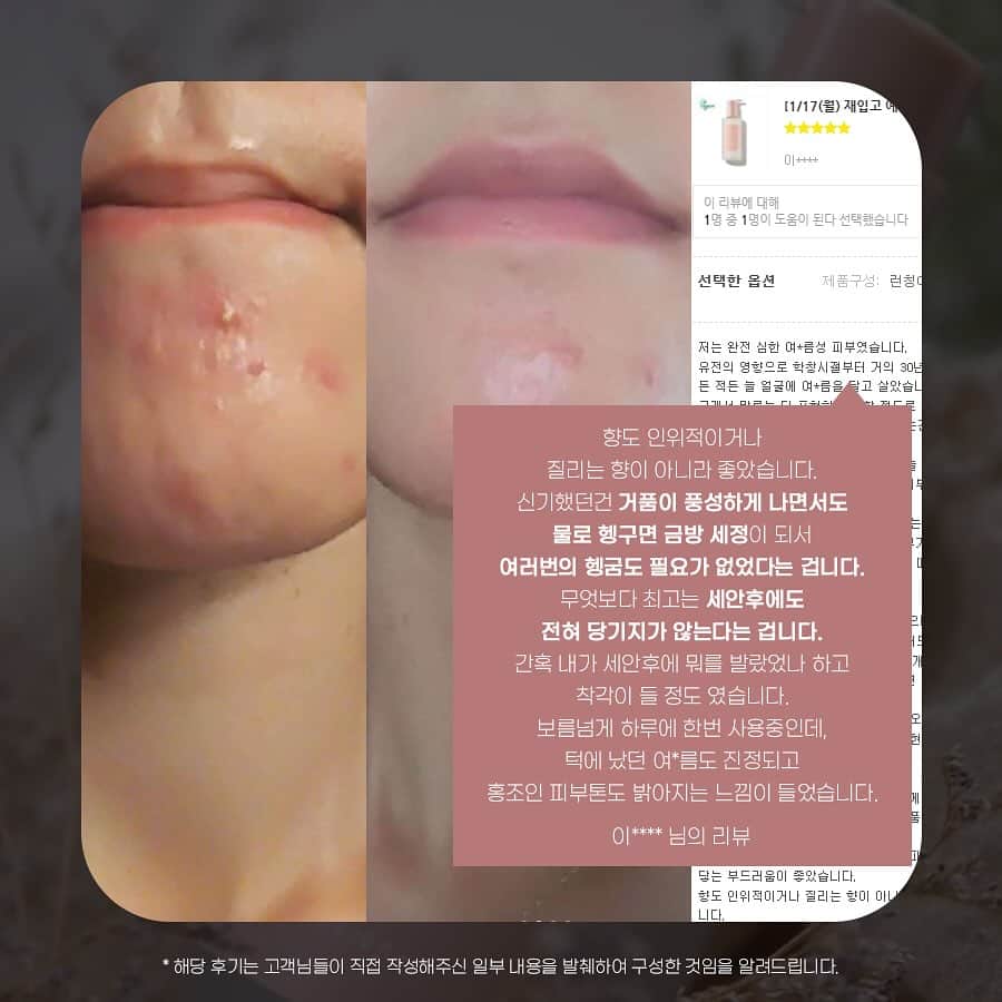 キム・ジュニのインスタグラム：「베이스킨 폼클렌저가 입소문 난 이유! 써보신 분들이 극찬해주시기 때문이에요 피부의 근본적인 피부 장벽을 튼튼하게 해주고 피부환경을 좋게 만들어 주기 때문에 세안제는 정말 중요해요  EWG 그린 등급의 순한 자연성분과 식물성 계면 활성제를 사용한 풍부한 거품 그리고 세안후 건조해지지 않는 촉촉한 보습의 힘은 단 한번의 사용만으로도 느끼실거에요  아직 입문전이시라면 이번 프로모션에 꼬옥 함께해주세요!  잠시후 11시 베이스킨 홈페이지에서 만나요  #베이스킨 @beiskin_official」