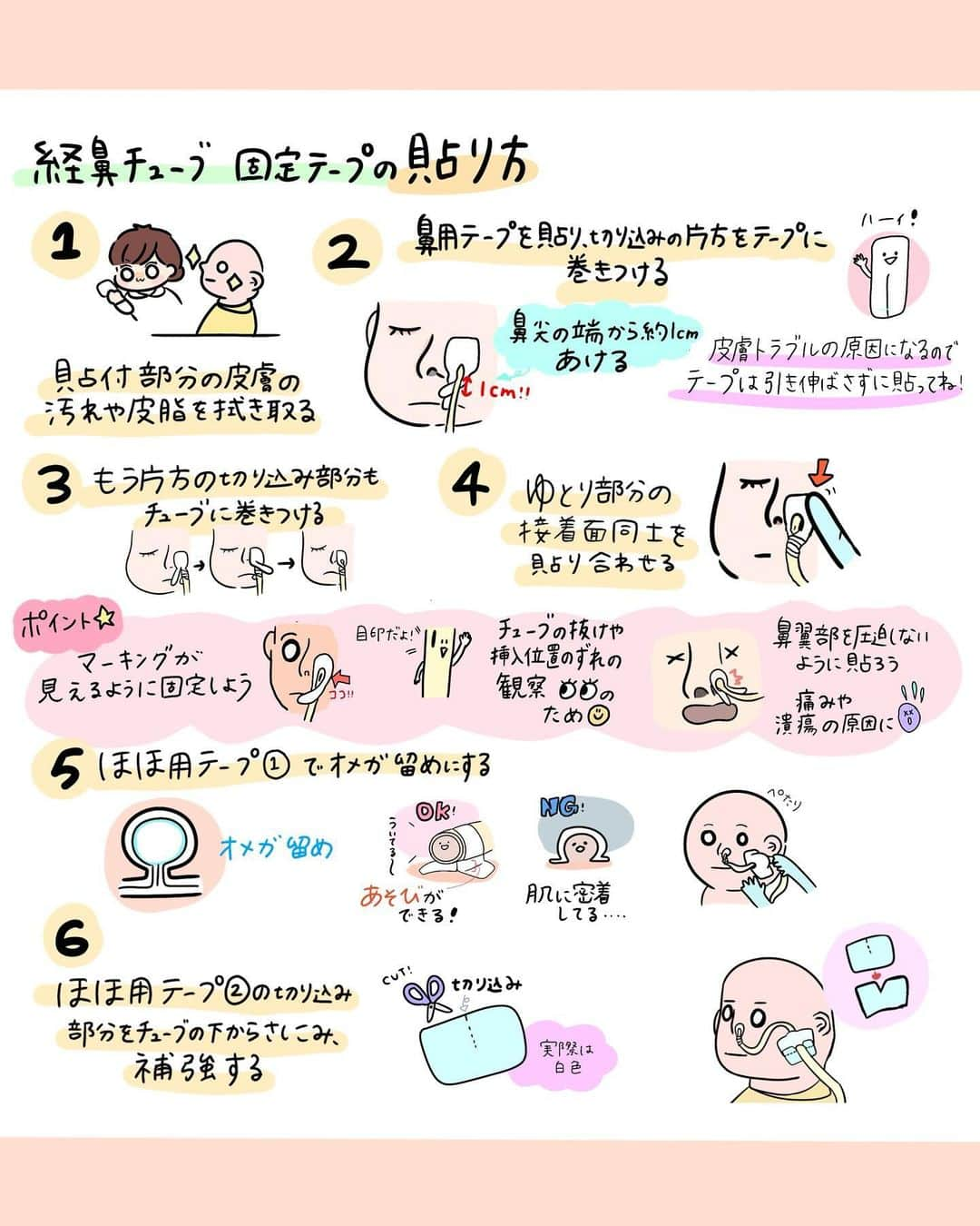 はやさんのインスタグラム写真 - (はやInstagram)「こんにちは🌞 看護師のはやです🐇  看護roo!さんで経鼻チューブの固定について描かせていただきました。 切り方、剥がし方、注意したい皮膚トラブルについて😇 どれも押さえておきたいポイント💡！  記事ではより詳しくまとめてるので、 ストーリーやハイライトからチェックしてね👀💫  #看護師#看護学生#看護師の勉強垢」10月27日 12時42分 - hayao_kam