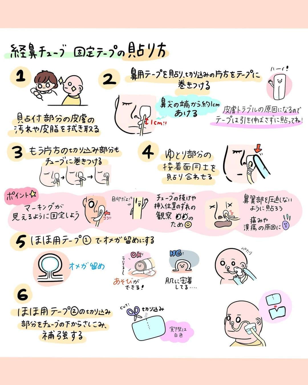 はやのインスタグラム：「こんにちは🌞 看護師のはやです🐇  看護roo!さんで経鼻チューブの固定について描かせていただきました。 切り方、剥がし方、注意したい皮膚トラブルについて😇 どれも押さえておきたいポイント💡！  記事ではより詳しくまとめてるので、 ストーリーやハイライトからチェックしてね👀💫  #看護師#看護学生#看護師の勉強垢」