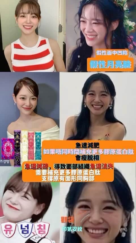 のインスタグラム：「急速減肥 如果唔同時間補充更多膠原蛋白肽 會瘦脫相 導致假性面中凹陷 假性月亮臉  急速減磅 導致面部組織急速流失 需要補充更多的膠原蛋白肽 支撐原有面形同胸部  #collage #collagendrink #膠原蛋白 #膠原飲 #整形級 #修復肌膚 #整形 #美白 #微整形 #醫美 #醫美術後」