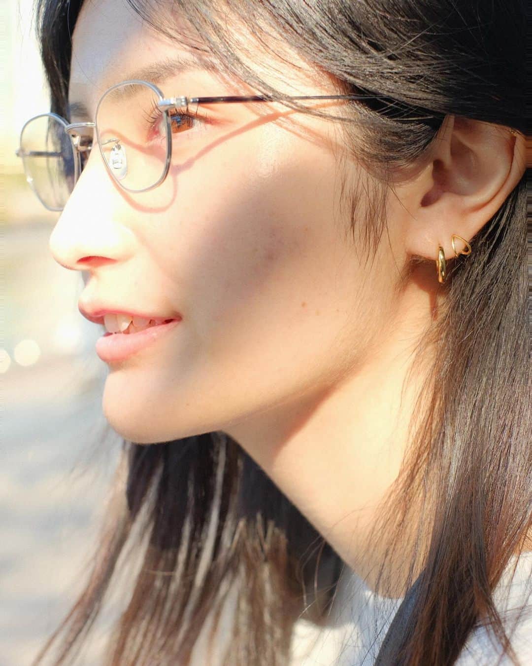 池谷実悠のインスタグラム：「数年前からAGAしているんですが、 顔の産毛の増加がすごいです。 頭の毛も生えました。」