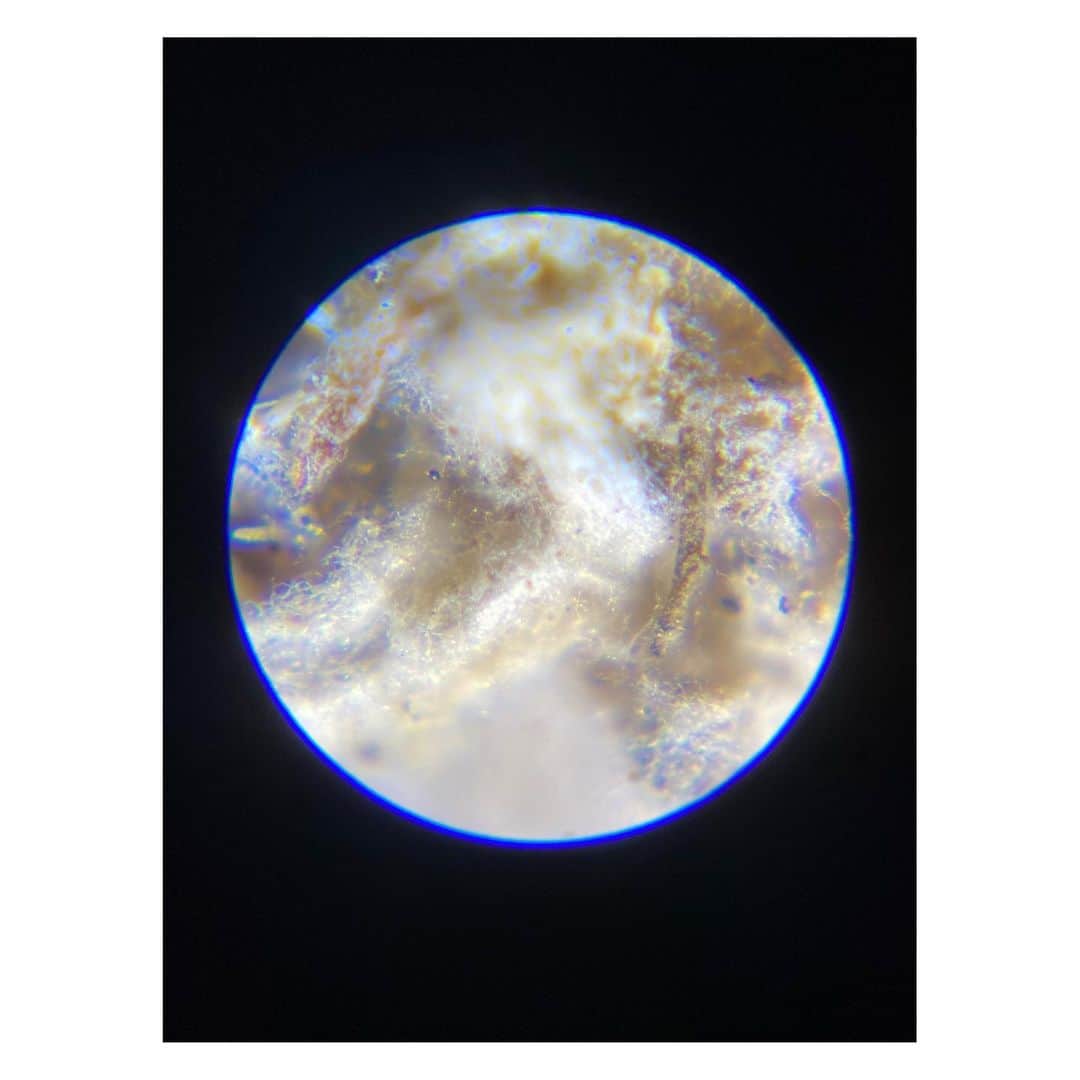 岩崎拓馬のインスタグラム：「🌏🌏🌏🌏 . . @syncs.earth   小さくて、大きい、宇宙をみた  顕微鏡でみた、菌の世界。  なんだかワクワクしてきた🫶🩷  Thank you @shibasaaki  . . #生地をたべる菌 #happytime」
