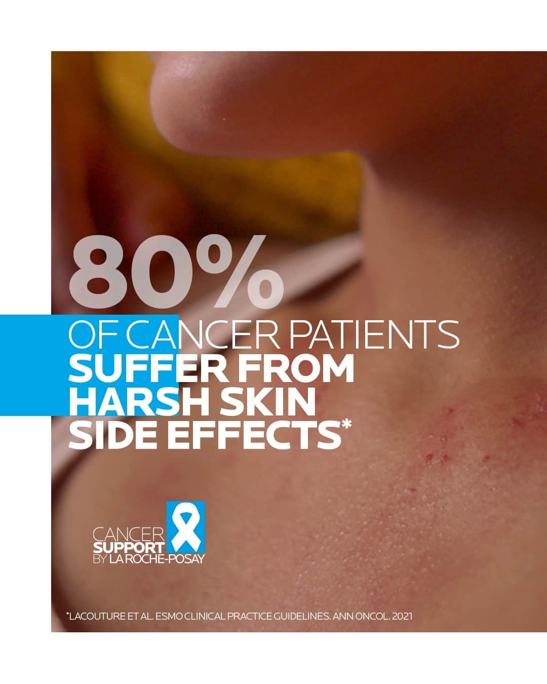 La Roche-Posayのインスタグラム：「80% of cancer patients suffer harsh skin side effects, that can lead to them to slow down or interrupt their treatment. On the occasion of Pink October, La Roche-Posay launches cancer-support.com, a free 15 min e-learning to raise awareness about the power of supportive care, for both cancer patients and their helpers.  1 session completed = 1€ donated to UICC, the global NGO uniting and supporting the cancer community to reduce the global cancer burden.  All languages spoken here! Feel free to talk to us at anytime. #larocheposay #pinkoctober #cancersupport  Global official page from La Roche-Posay, France.」