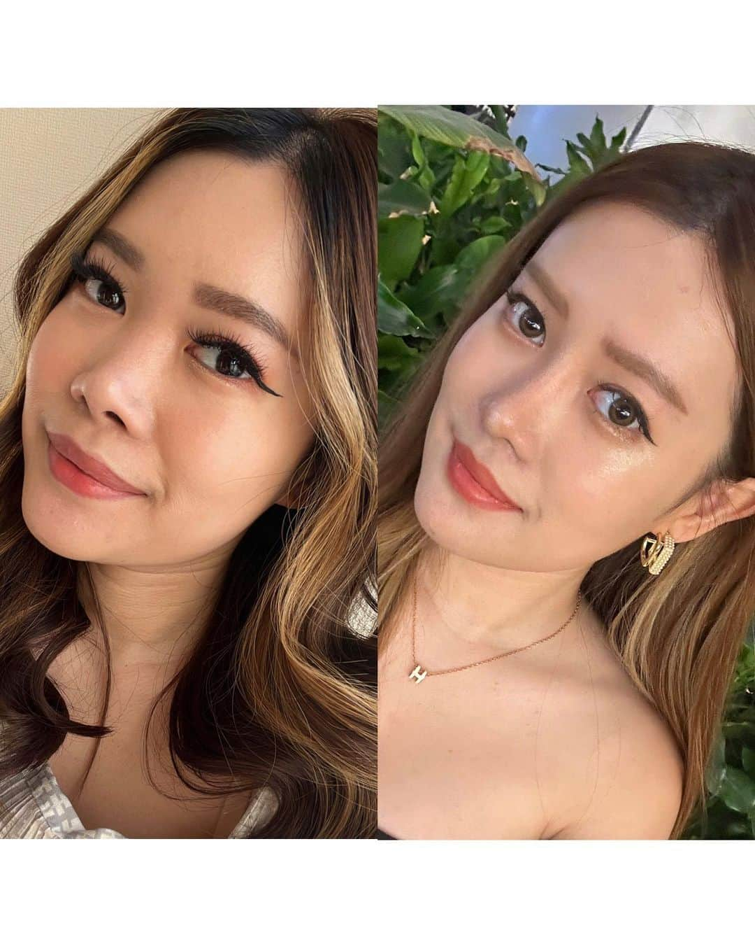 Stella Leeさんのインスタグラム写真 - (Stella LeeInstagram)「2 months post surgery update  A prettier version of myself 🫣❤️  Still feel stiff on my lower face area, my nose still feels hard. I have moved from porridge diet to rice and noodles 🫶🏻 Foods that I can eat have increased and I am trying to make my chew better by stretching my jaw 😂」10月10日 20時28分 - stellalee92