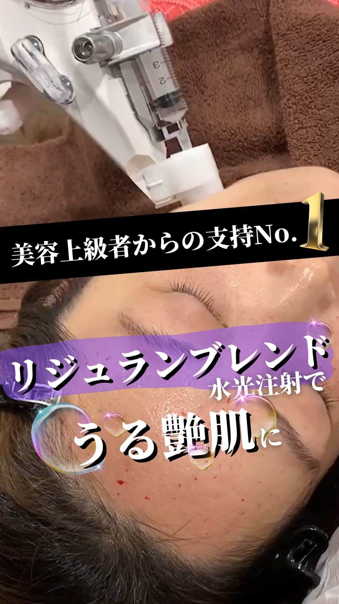 恵比寿フィラークリニックのインスタグラム