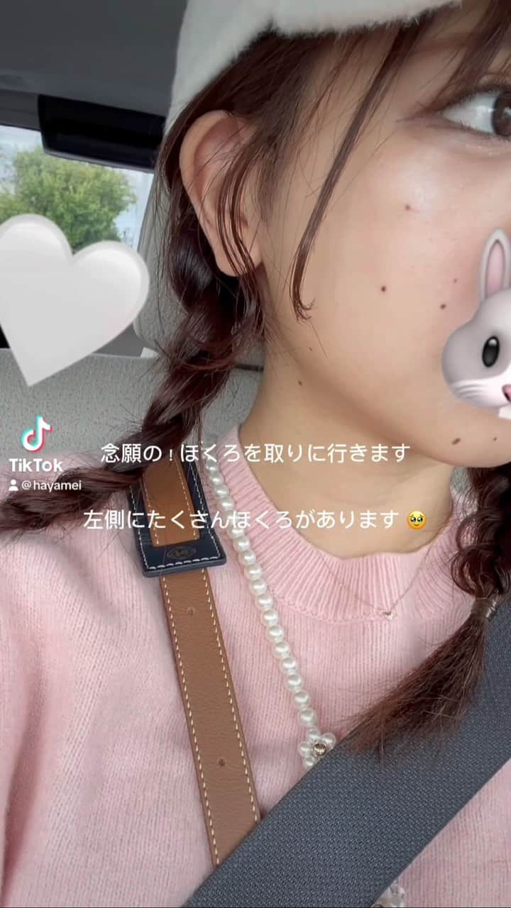 はやめいのインスタグラム：「. 生理前で肌荒れしていますが🫣 念願のほくろ除去 ！🥹  綺麗に消えてくれたらいいな(˶՞･֊･՞˶)   目の下と 顎のほくろは 残しました ( *ᐢ´꒳`ᐢ* ) #ほくろ除去 #美容 #美容day #vlog」