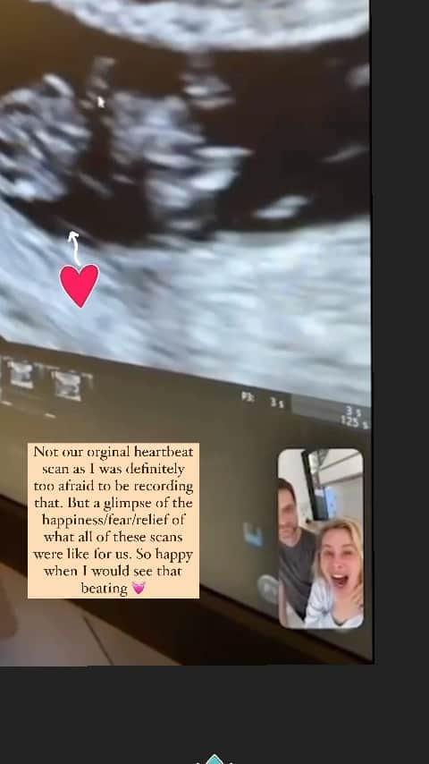 タラ・リピンスキーのインスタグラム：「Early scans 💓 This was not the original heartbeat scan as I was a total mess and way too afraid to record it but here is one shortly after.  Truthfully I was so relieved that I didn’t have to be in that room to relive so many of my past memories. Mikayla and I always had a plan from day 1. She would only FaceTime me once the heartbeat was up and everything looked good. It’s sad to say these scans are never “fun” for me, infertility took that away.   There is so much fear and anxiety leading up to and during the scans but I can’t describe the overwhelming feeling of gratitude that I feel. As well as relief and also I’m just constantly stunned by good news. We were never the good news people. Very surreal. And so very grateful.   P.s  I see all of you still the in the wait. I struggle with feelings of guilt as I was you for so long and know those feelings so well. I am just rooting so hard for you all.   #infertility #pregnancyafterloss #ivf #ivfjourney #fertility #ttc #ttccommunity #surrogate #surrogacy #surrogacyjourney」
