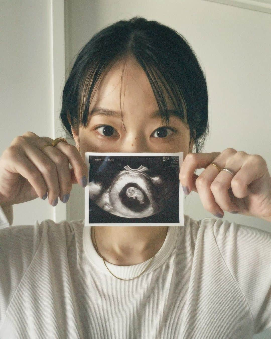 菜香さんのインスタグラム写真 - (菜香Instagram)「🤍ご報告🤍 この度、新しい命を授かりました👶🏻 現在安定期に入り、すくすく成長中です🌱🐣 想像の100倍しんどかった悪阻は一生忘れません😂笑 そして日々支えてくれる旦那さん、家族、友人にも心から感謝です🥹🩷 今は悪阻も落ち着き、美味しいご飯が食べれる喜びを日々実感しております🍚 お腹と相談しながらお仕事は続けて参りますのでどうぞよろしくお願いいたします🤰🏻」10月12日 21時21分 - saika518