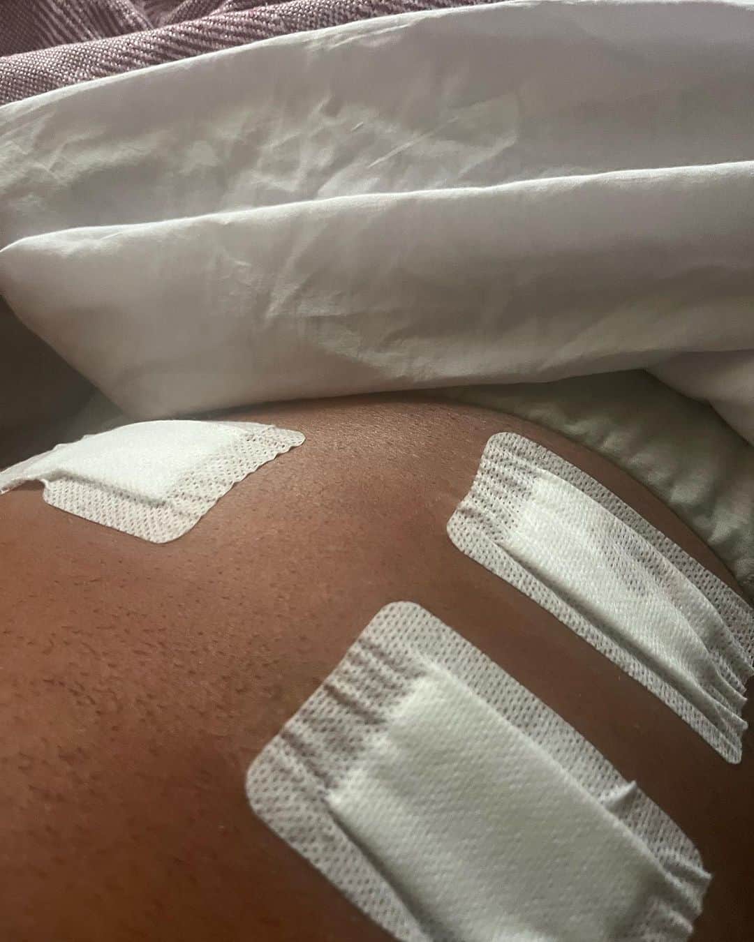 デイビーボーイ・スミス・ジュニアのインスタグラム：「I wanted to inform everyone officially I needed to have Emergency surgery 🏥 👨‍⚕️ ❤️‍🩹 late last night for appendicitis + appendix removal, to find out it was diverticulitis as well. 😬I have had part of colon removed with some of my appendix as well for the procedure 😷🤕🤒. Folks this was one of the most painful experiences of my life, but I’m glad I got it done. A burst appendix can lead to serious complications too. I’m sad to announce my withdrawal from the @majorleaguewrestling World Title Match vs. Alex Kane this weekend in Philadelphia as well😔. Hopefully I can get this same opportunity in the future when I’m back healthy, and so sorry to my fans, these things happen and was not something I ever want to endure again! Trust me! The was a 12/10 in the pain scale. Arigatou. I’m in stable condition now, but I am still in immense pain 😷😫🤒I’ll keep everyone posted with updates.  Thanks for everyone reaching out to me also.  -Harry」