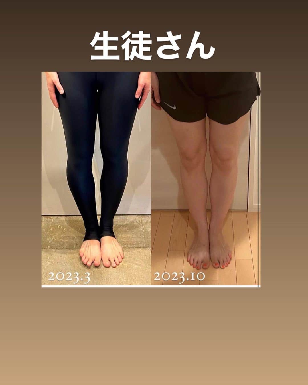 村田友美子さんのインスタグラム写真 - (村田友美子Instagram)「脚の形って変わるんですか？ 脚だけ細くできますか？ ってよく聞かれます。  こたえは やることやって 頑張れば変わる‼️  Ｏ脚で悩んでるひと、前ももパンパン、ふくらはぎが太い！とかも遺伝かと思いきや実は単なる歪みなんだよね。  一枚めの写真のかなこちゃんは 40年間ずーっとＯ脚に悩んでて ありとあらゆる整体、エステ、トレーニング、、、あやしさ全開なとこも多数経験したらしい。  でもユミコア始めてだんだん良くなって、今や真っ直ぐだし細いしお尻も超丸くて上にあるし完全にＯ脚のイメージゼロ‼️  骨って動くんだなぁって。伝わるかな？ 骨が動くと筋肉や脂肪のつき方も変わるから細くなったり見え方が変わる🫶🏻  筋トレしたら脚が細くなるって思っている人がよくいるけど、その前にやることがいっぱいある。  ⭐️足裏や足指をゆるめたりたくさん動かす ⭐️内側や外側に落ちている足首を整える ⭐️股関節まわりをゆるめる ⭐️股関節と骨盤をはめこむ ⭐️もろもろインナーのトレーニング(クラムやうちももトレなど) ⭐️歩きかた(重心の位置)を変える などなど  かなこちゃんからのメッセージ 脚を治すにはとにかく脚だけやれば良いと思ってたけど実は呼吸とコアがすごく大事なことに気づいたってラインくれた。  Ｏ脚や脚の太さ、下半身で悩んでる人はあきらめないで やろう‼️‼️‼️  一番最後の動画、私よくやるやつ❤️  #Ｏ脚改善 #骨の向きを変える #筋トレではない #脚は細くなる #ただ歪みがあるだけ #とりあえずやろ @onlineyumicore  @yumicorebodyofficial」10月13日 23時49分 - yumicorebody